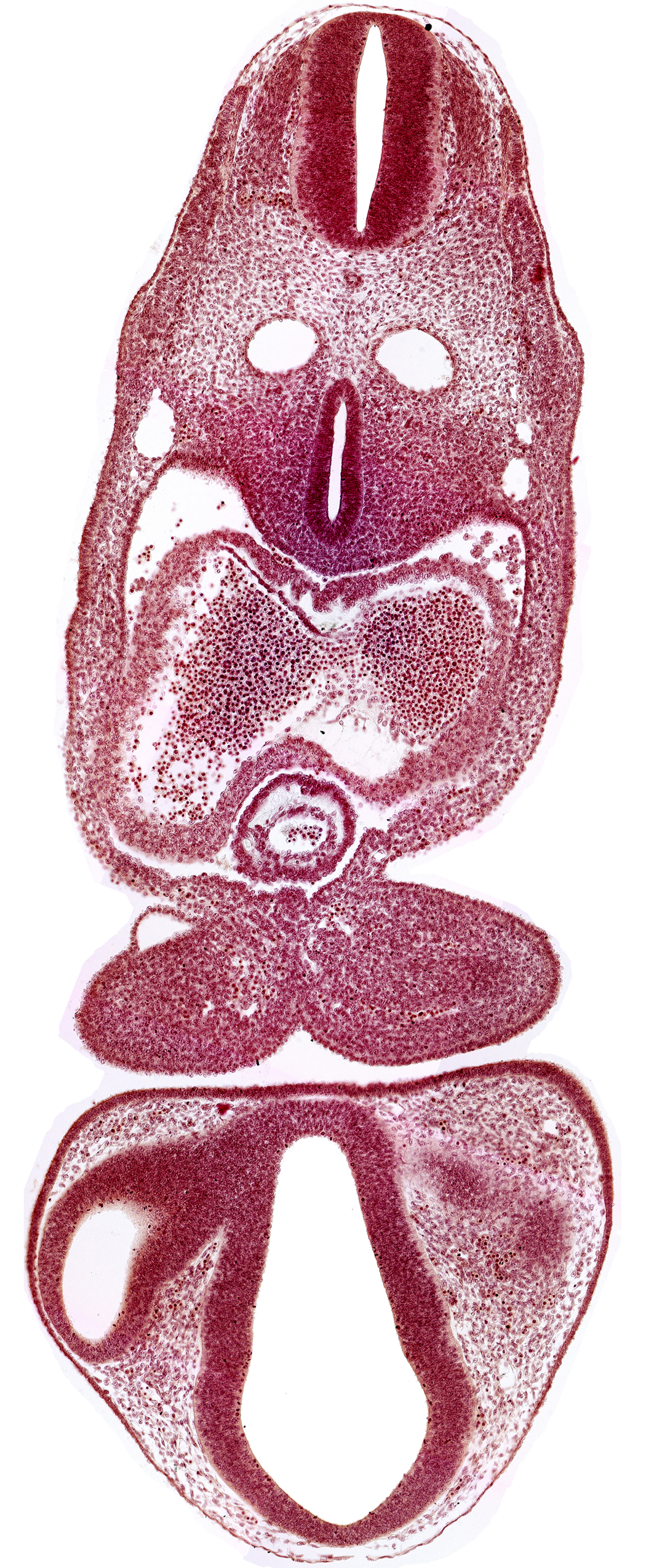caudal edge of left optic vesicle, chiasmatic part of diencephalon, dermatomyotome 5 (C-1), dermatomyotome 6 (C-2), dorsal aorta, endocardium, epicardial ridge, intraretinal space (optic vesicle cavity), left atrium, mandibular prominence of pharyngeal arch 1, marginal layer of spinal cord, median mandibular groove, notochord, optic stalk (CN II), pericardial cavity, precardinal vein, prosencoel (third ventricle), right atrium, separation artifact, tracheo-esophageal tube, truncus arteriosus, ventral thalamus