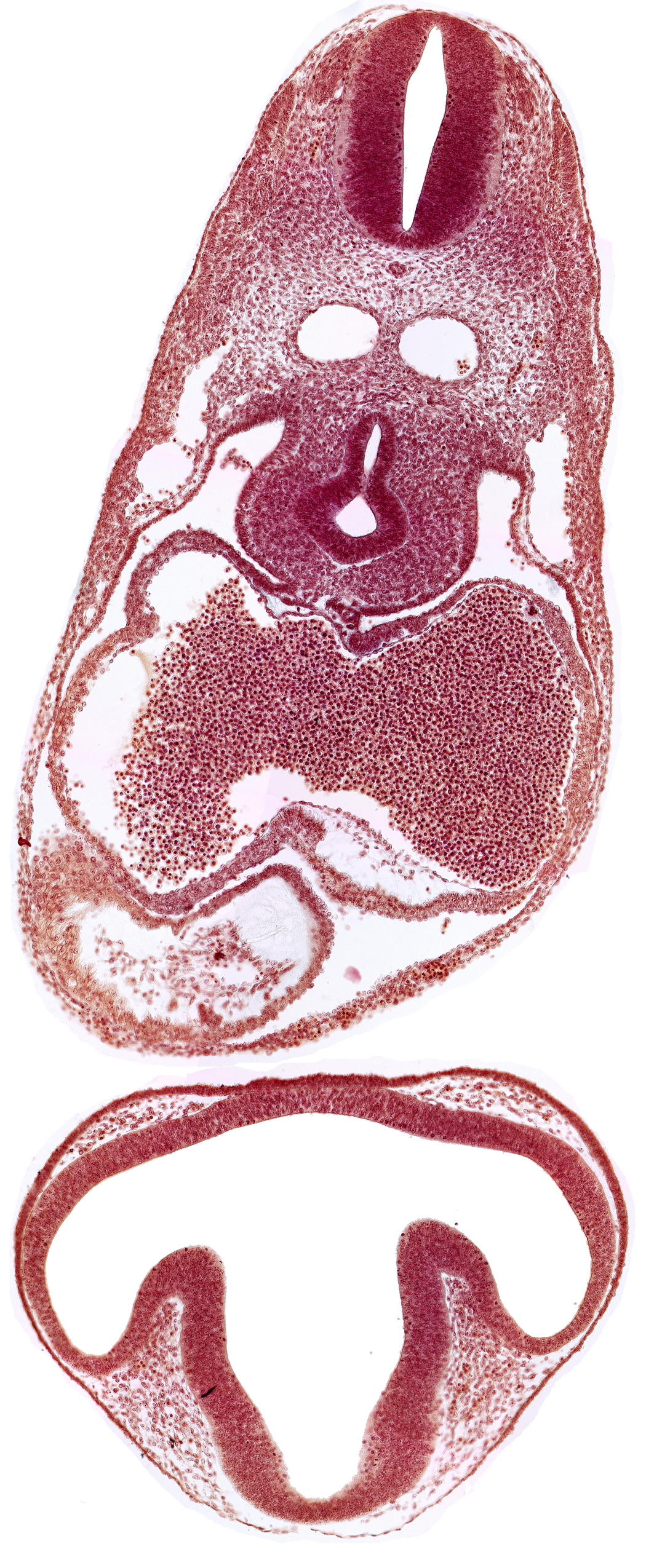 bulbis cordis, dermatomyotome 6 (C-2), diencephalon, dorsal aorta, esophagus primordium, intraretinal space (optic vesicle cavity), junction of postcardinal and precardinal veins, lens disc, mesocardium, nucleated red blood cells in left atrium, ostium primum, pericardial cavity, precardinal vein, primary interatrial septum (septum primum), right atrium, trachea primordium