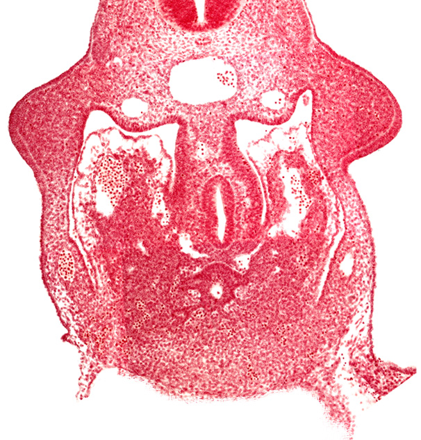 Liver - Section