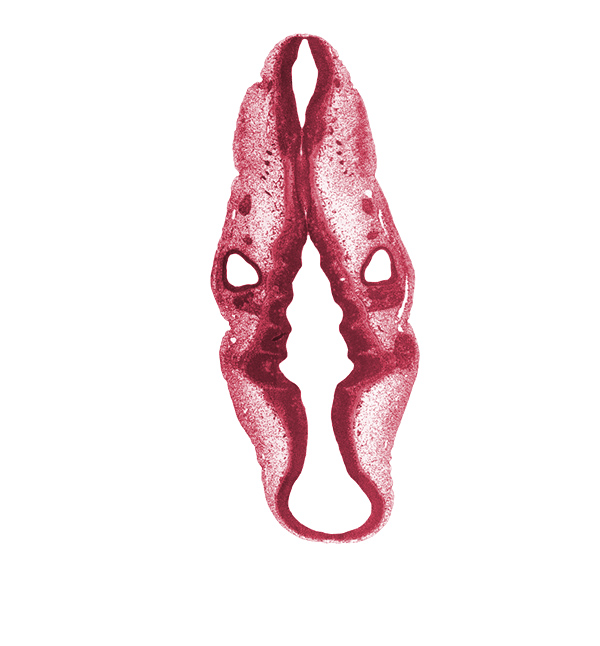 anterior dural venous plexus, intermediate zone, isthmus of rhombencephalon, marginal zone, mesencephalon (M2), metencephalon, rhombomere 1, rhombomere 2, rhombomere 3, rhombomere 4, root of hypoglossal nerve (CN XII), stem of middle dural venous plexus, stem of posterior dural venous plexus, sulcus limitans, superior ganglion of glossopharyngeal nerve (CN IX), superior ganglion of vagus nerve (CN X), trigeminal ganglion (CN V), ventricular zone