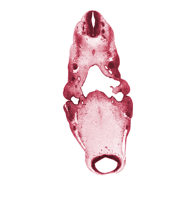 caudal edge of C-1 spinal ganglion, dorsal aorta, hypoglossal nerve (CN XII), inferior ganglion of glossopharyngeal nerve (CN IX), inferior ganglion of vagus nerve (CN X), internal carotid artery, junction of precardinal and primary head veins, maxillary nerve (CN V₂), mesencephalon (M1), mesencoel (cerebral aqueduct), neural canal, notochord, ophthalmic nerve (CN V₁), pharyngeal arch 1, pharyngeal arch 2, pharyngeal pouch 1, pontine flexure region, posterior cerebral artery, primary maxillary vein, spinal accessory nerve (CN XI), stem of anterior dural venous plexus