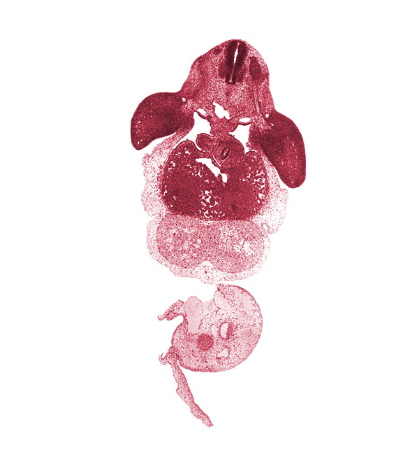 C-7 spinal ganglion, C-7 spinal nerve, amnion attachment, anterior interventricular groove, blastema of proximal humerus, brachial plexus, caudal edge of right lung sac, cephalic end of mesonephros, cephalic recess of lesser sac (omental bursa), common umbilical vein, intermediate zone, interventricular septum, junction of dorsal aortas, junction of ductus venosus and inferior vena cava, left umbilical artery, left ventricle, marginal zone, neural canal, notochord, pericardial sac, peritoneal cavity, postcardinal vein, posterior interventricular sulcus, right umbilical artery, right ventricle, stomach, sulcus limitans, umbilical cord, ventricular zone