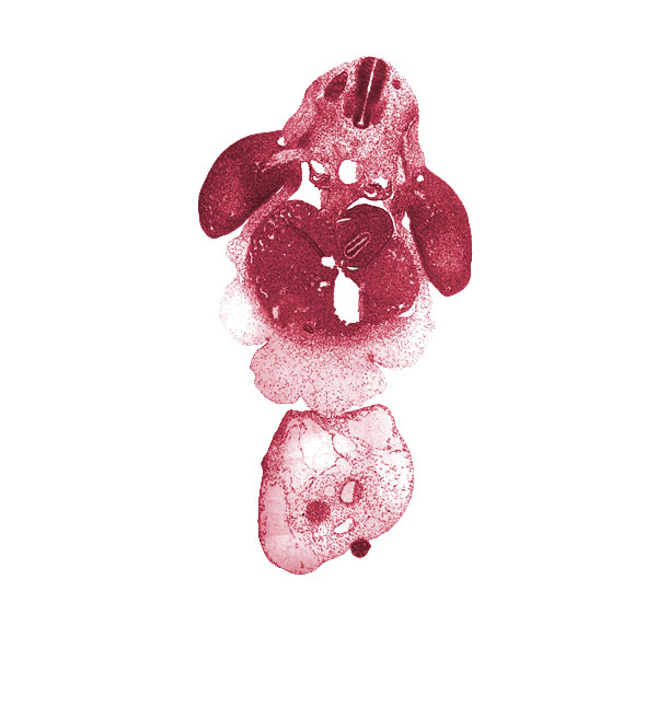 aorta, brachial plexus, caudal part of pericardial sac, cephalic edge of C-8 spinal ganglion, common umbilical vein, dermatome, dorsal mesogastrium, ductus venosus, gall bladder primordium, junction of mesonephric duct and tubule, left lobe of liver, left umbilical artery, lesser sac, myotome, neural tube, post anal gut, postcardinal vein, right lobe of liver, right umbilical artery, septum transversum, stomach, tip of caudal eminence, umbilical coelom, umbilical cord, upper limb