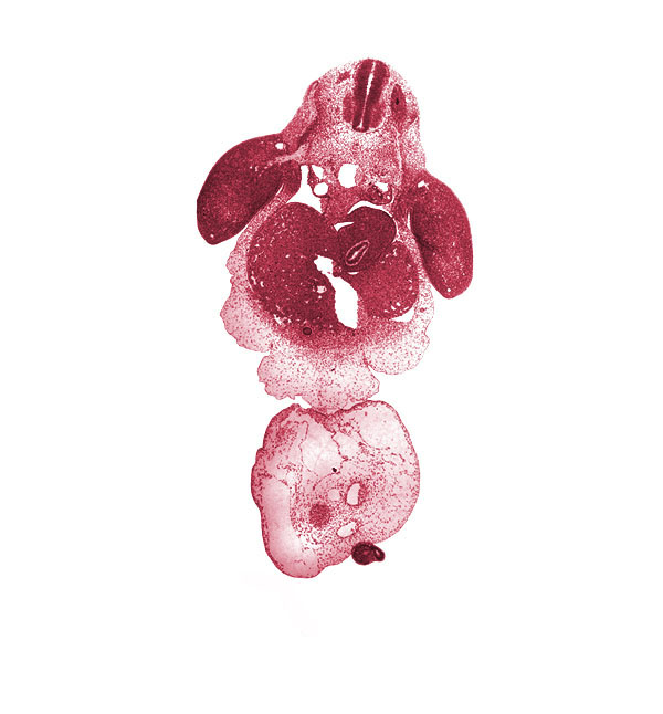 C-8 spinal ganglion, C-8 spinal nerve, C-8 ventral root, amnion on surface of umbilical cord, aorta, brachial plexus, caudal eminence, common umbilical vein, ductus venosus, gall bladder primordium, left lobe of liver, left umbilical artery, lesser sac, marginal vein, mesonephric duct, neural tube, notochord, peritoneal cavity, post anal gut, postcardinal vein, right lobe of liver, right umbilical artery, septum transversum, spleen primordium, stomach, umbilical coelom
