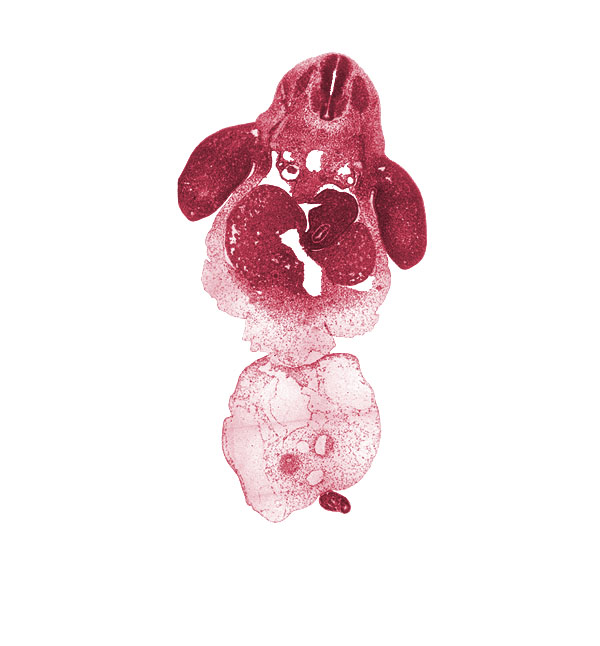 C-8 spinal ganglion, aorta, bile duct, common umbilical vein, dorsal mesentery, dorsal mesogastrium, ductus venosus, left lobe of liver, left umbilical artery, lesser  sac, marginal vein, mesonephric duct, neural canal, neural tube, notochord, post anal gut, postcardinal vein, right lobe of liver, right umbilical artery, sclerotome, septum transversum, spleen primordium, stomach, umbilical coelom, umbilical cord, ventral mesogastrium