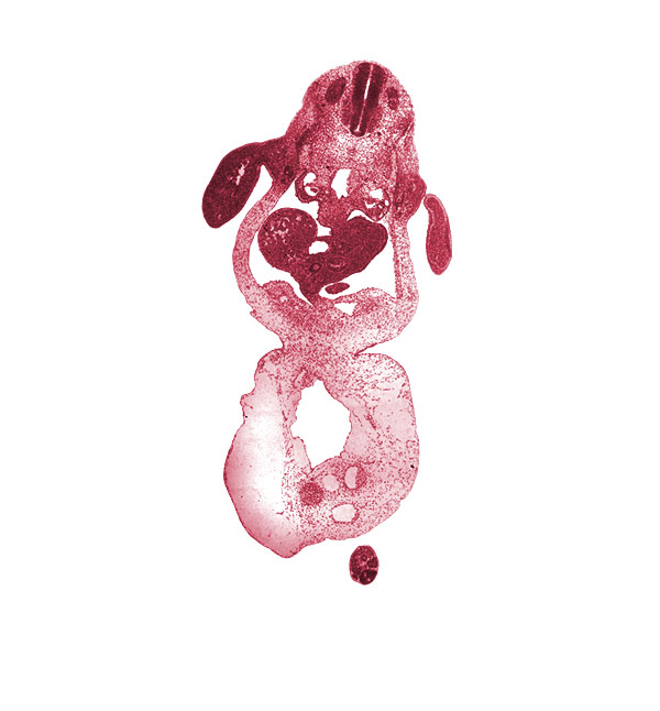 C-8 spinal ganglion, allantois, aorta, caudal edge of left lobe of liver, caudal eminence, coccygeal somites, common umbilical vein, dermatome, dorsal mesogastrium, duodenum, epiploic foramen, involuting right umbilical vein, junction of bile duct and hepatic ducts, left umbilical artery, left umbilical vein, lesser sac, myotome, neural tube, notochord, omphalomesenteric (superior mesenteric) vein, post anal gut, right lobe of liver, right umbilical artery, sclerotome, septum transversum, umbilical coelom, umbilical cord, upper limb