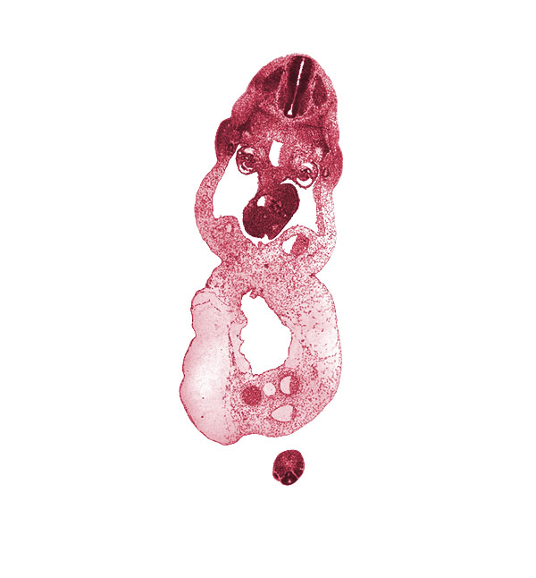 T-1 spinal ganglion, allantois, aorta, coccygeal somites, dorsal pancreas, duodenum, glomerular capsule, involuting right umbilical vein, left umbilical artery, left umbilical vein, mammary crest, mesonephric duct, neural tube, notochord, omphalomesenteric (superior mesenteric) vein, peritoneal cavity, post anal gut, postcardinal vein, right umbilical artery, umbilical coelom, ventral pancreas