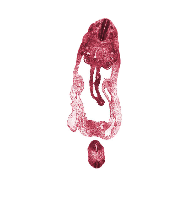 S-3 spinal ganglion, abdominal wall, allantois, aorta, caudal edge of T-2 spinal ganglion, cephalic edge of T-3 spinal ganglion, cloaca, cloacal membrane, dermatomyotome, dorsal mesentery, glomerulus, involuting right umbilical vein, left umbilical artery, left umbilical vein, mesonephric duct, midgut, notochord, omphalomesenteric (superior mesenteric) vein, peritoneal cavity, postcardinal vein, right umbilical artery, sclerotome, superior mesenteric artery, surface ectoderm, umbilical coelom, ventral body wall