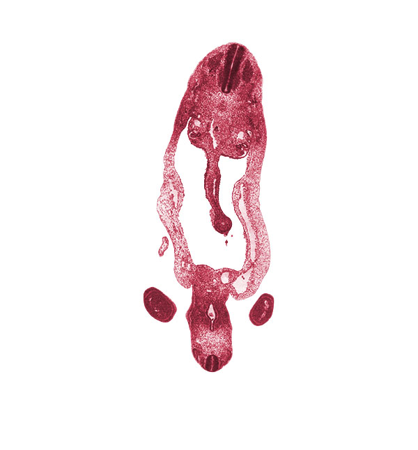 S-2 spinal ganglion, T-3 spinal ganglion, allantois, cloaca, dermatome, dermatomyotome, ectoderm, hindgut, involuting right umbilical vein, left umbilical artery, left umbilical vein, lower limb, mammary crest, marginal vein, mesonephric duct, mesonephros, mesothelium, midgut loop, myotome, notochord, omphalomesenteric (superior mesenteric) vein, peritoneal cavity, postcardinal vein, right umbilical artery, sclerotome