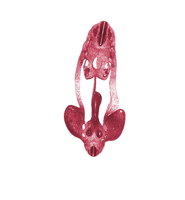 L-5 spinal ganglion, T-4 spinal ganglion, alar plate(s), aorta, basal plate, cephalic edge of metanephric diverticulum, dermatome, distal limb of midgut loop, dorsal mesentery, floor plate, gonadal ridge, hindgut, inferior mesenteric artery, junction of hindgut and midgut, lower limb, mesonephric duct, mesonephric tubule(s), metanephric cap, metanephric diverticulum, myotome, notochord, peritoneal cavity, postcardinal vein, roof plate, sclerotome, sulcus limitans