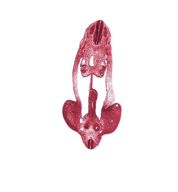 L-5 spinal ganglion, T-4 spinal ganglion, abdominal wall, aorta, cephalic edge of metanephric cap, common iliac artery, dorsal mesentery, edge of hindgut, external iliac artery, gonadal ridge, inferior mesenteric artery, intermediate zone, internal iliac artery, junction of mesonephric duct and tubule, marginal zone, mesonephric duct, mesonephric vesicle(s), metanephric cap, metanephric diverticulum, notochord, postcardinal vein, ventricular zone