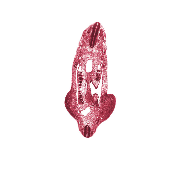 L-4 spinal ganglion, T-5 spinal ganglion, aorta, aortic bifurcation, dense caudal part of sclerotome, dorsal mesentery, gonadal ridge, hip region, inferior mesenteric artery, junction of mesonephric duct and tubule, mesonephric duct, mesonephric vesicle(s), myotome, notochord, peritoneal cavity, postcardinal vein, surface ectoderm