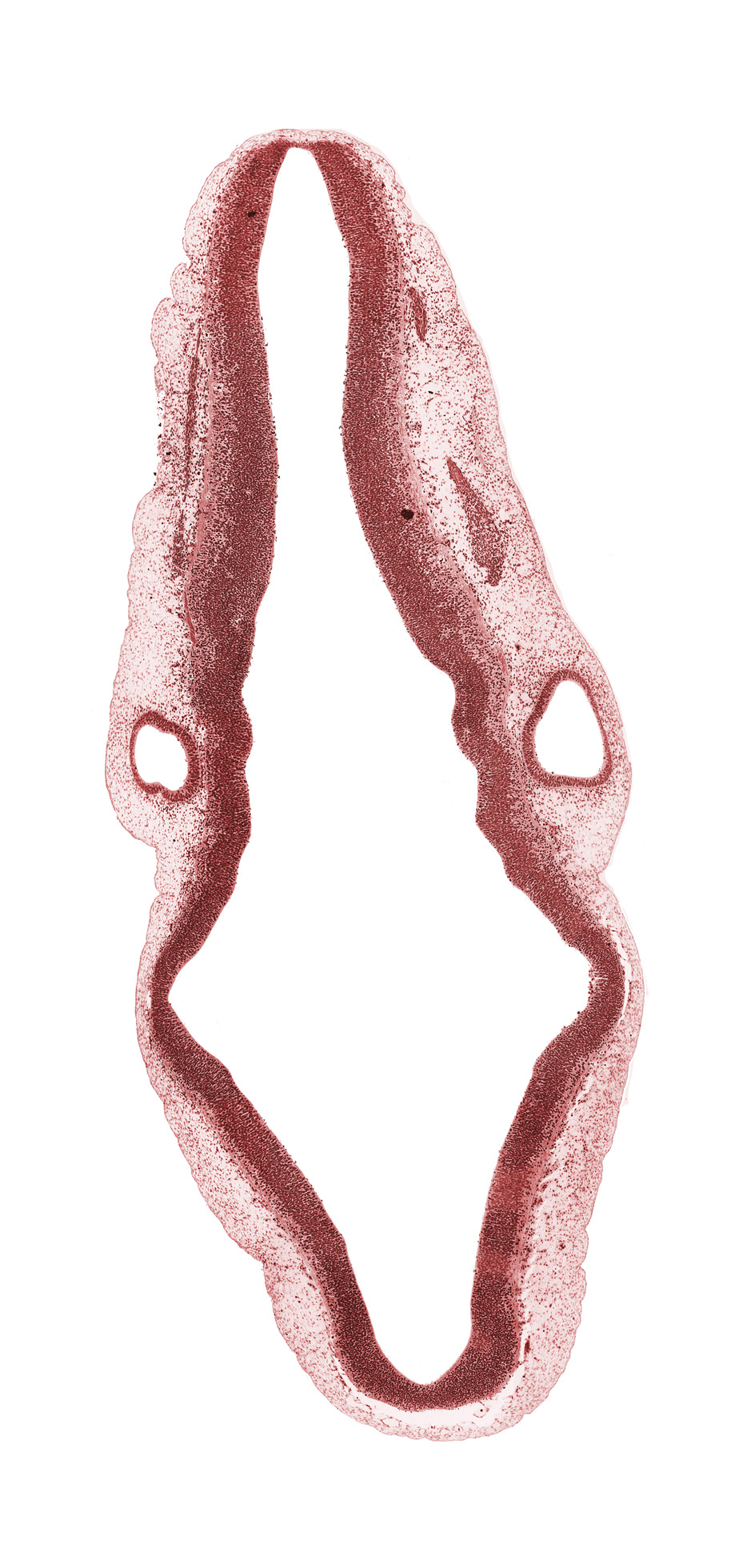 basal plate, head mesenchyme, isthmus of rhombencephalon, mesencephalon (M2), otic capsule, posterior dural venous plexus, rhombencoel (fourth ventricle), rhombomere 1, rhombomere 2, rhombomere 3, rhombomere 4, rhombomere 5, rhombomere 6, rhombomere 7, spinal accessory nerve (CN XI), sulcus limitans, superior ganglion of vagus nerve (CN X), transverse rhombencephalic sulcus, vestibular part of otic vesicle