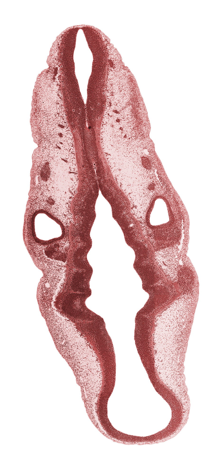 anterior dural venous plexus, intermediate zone, isthmus of rhombencephalon, marginal zone, mesencephalon (M2), metencephalon, rhombomere 1, rhombomere 2, rhombomere 3, rhombomere 4, root of hypoglossal nerve (CN XII), stem of middle dural venous plexus, stem of posterior dural venous plexus, sulcus limitans, superior ganglion of glossopharyngeal nerve (CN IX), superior ganglion of vagus nerve (CN X), trigeminal ganglion (CN V), ventricular zone