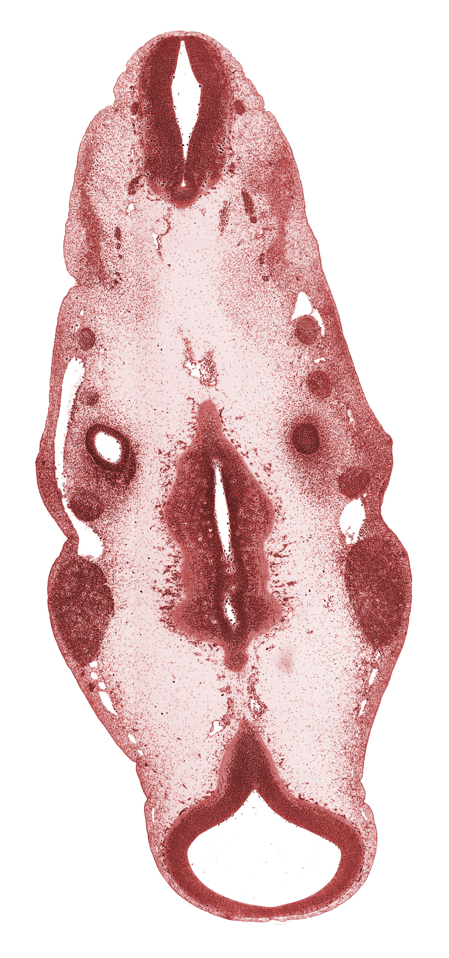 caudal edge of cochlear duct primordium, geniculate ganglion (CN VII), intermediate zone, junction of basilar artery and vertebral arteries, marginal zone, metencephalon, metencephalon (presumptive pons region), otic capsule, posterior cerebral artery, precardinal vein, primary head vein, root of hypoglossal nerve (CN XII), spinal accessory nerve (CN XI), sulcus limitans, superior ganglion of glossopharyngeal nerve (CN IX), superior ganglion of vagus nerve (CN X), trigeminal ganglion (CN V), ventral edge of rhombencoel (fourth ventricle), ventricular zone, vertebral artery