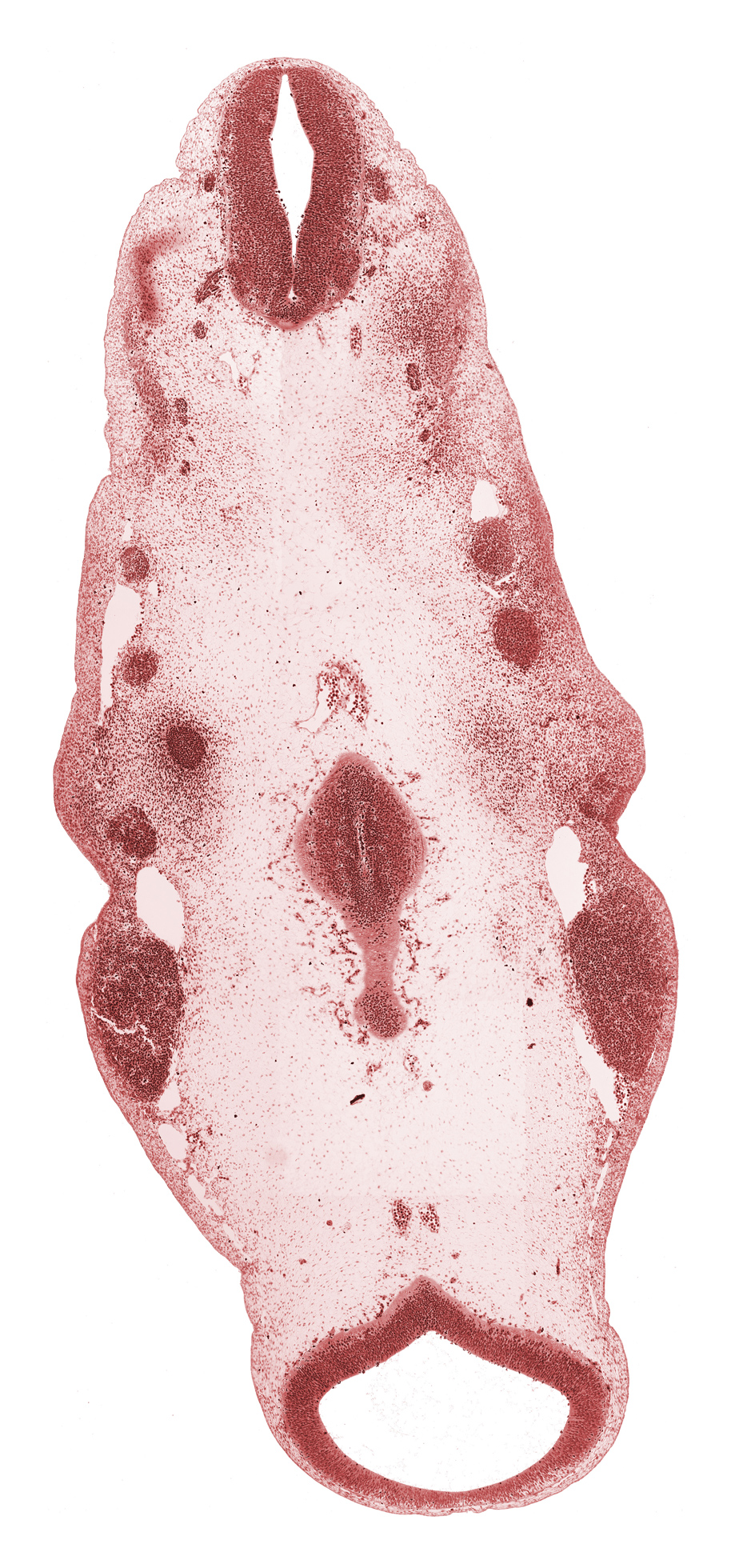 anterior dural venous plexus, caudal part of myelencephalon, caudal part of rhombencoel (fourth ventricle), edge of metencephalon, epipharyngeal placode, geniculate ganglion (CN VII), inferior ganglion of glossopharyngeal nerve (CN IX), inferior ganglion of vagus nerve (CN X), mesencephalon, mesencoel (cerebral aqueduct), otic capsule, pharyngeal groove 1, posterior cerebral artery, precardinal vein, primary head vein, region of mesencephalic (cephalic) flexure, spinal accessory nerve (CN XI), stem of anterior dural venous plexus, tectum of mesencephalon, tegmentum of mesencephalon, trigeminal ganglion (CN V), unfused basilar artery, vertebral artery