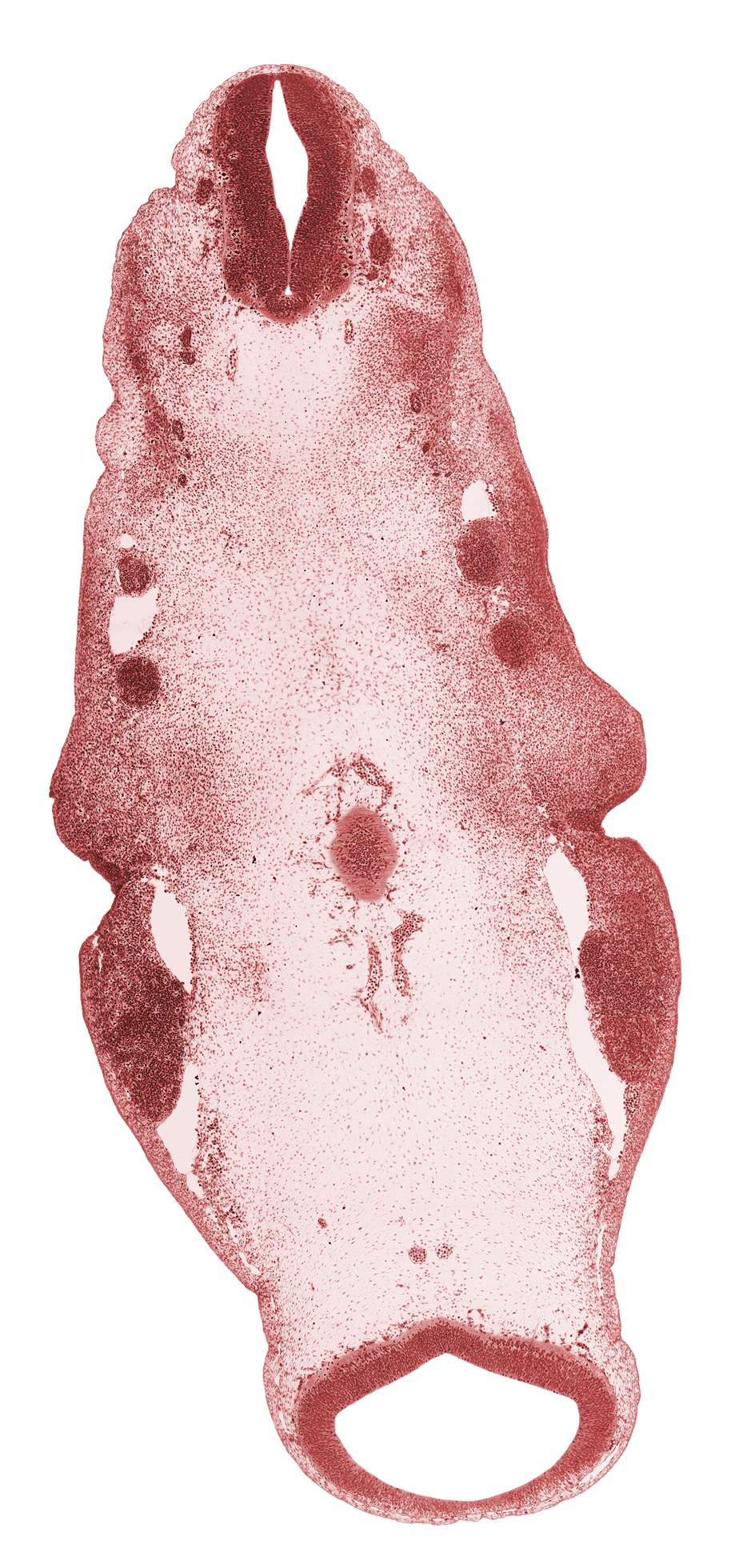 cephalic edge of C-1 spinal ganglion, edge of metencephalon, inferior ganglion of glossopharyngeal nerve (CN IX), inferior ganglion of vagus nerve (CN X), junction of brain and spinal cord, junction of primary head vein and stem of anterior dural venous plexus, mesencephalon (M2), mesencoel (cerebral aqueduct), neural canal, pharyngeal arch 1, pharyngeal arch 2, pharyngeal groove 1, posterior cerebral artery, primary head vein, region of cervical flexure, region of mesencephalic (cephalic) flexure, trigeminal ganglion (CN V), unfused basilar artery, vertebral artery