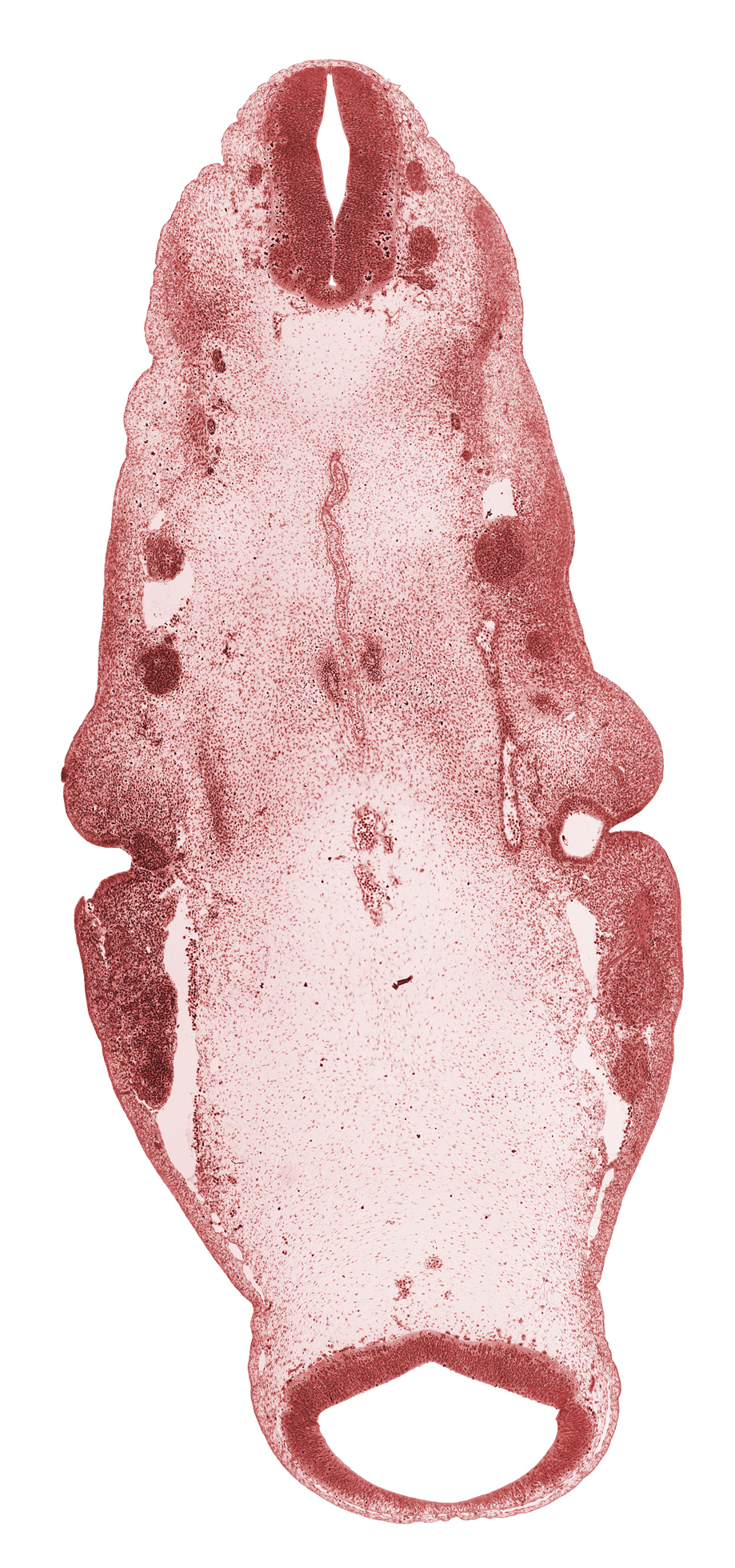 C-1 spinal ganglion, C-1 ventral root, cephalic edge of pharynx, fused basilar artery, inferior ganglion of glossopharyngeal nerve (CN IX), inferior ganglion of vagus nerve (CN X), junction of dorsal aorta and internal carotid artery, maxillary nerve (CN V₂), mesencephalon (M1), notochord, ophthalmic nerve (CN V₁), parachordal condensation, pharyngeal arch 1, pharyngeal groove 1, pharyngeal pouch 1, pontine flexure region, posterior cerebral artery, primary head vein, region of cervical flexure, spinal accessory nerve (CN XI), stem of anterior dural venous plexus, sulcus limitans, tectum of mesencephalon, tegmentum of mesencephalon