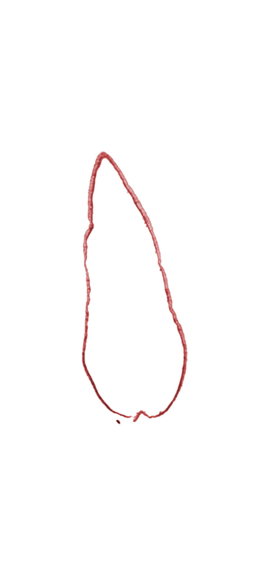 head mesenchyme, rhombencoel (fourth ventricle), roof plate of rhombencephalon, surface ectoderm