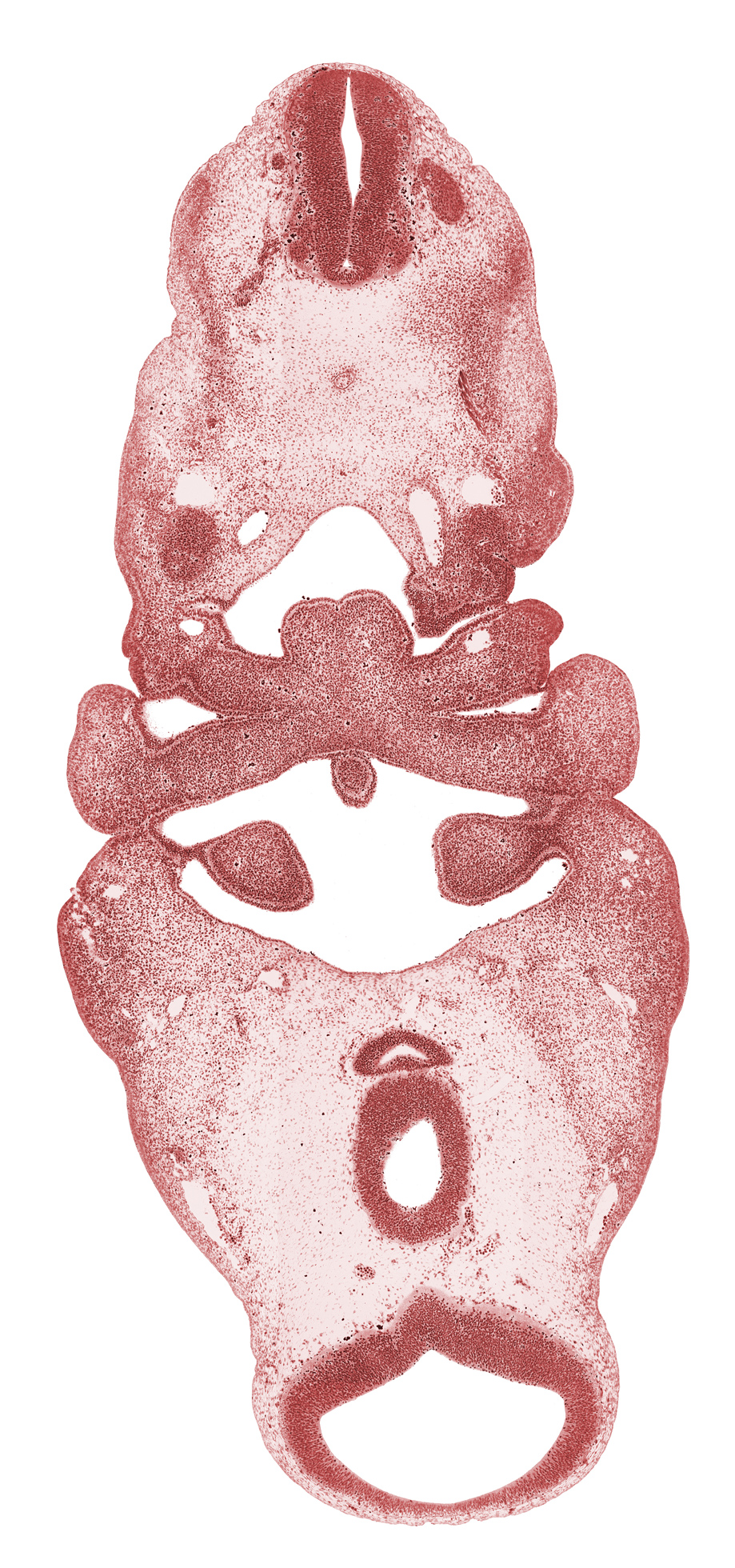 C-1 spinal nerve, aortic arch 3, aortic arch 4, cephalic edge of C-2 spinal ganglion, diencephalon, diencoel (third ventricle), dorsal aorta, edge of adenohypophysial pouch, hypopharyngeal eminence of tongue, inferior ganglion of vagus nerve (CN X), lateral lingual swelling of tongue, mesencephalon (M1), mesencoel (cerebral aqueduct), notochord, pharyngeal arch 3, pharyngeal arch 4, pharyngeal groove 1, pharyngeal pouch 2, posterior communicating artery, precardinal vein, spinal accessory nerve (CN XI), spinal cord, thyroglossal duct, tuberculum impar of tongue