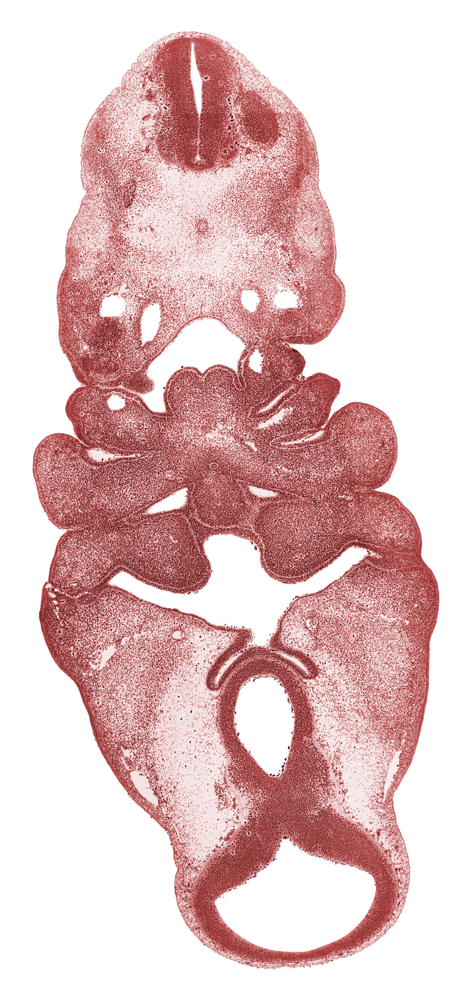 C-2 spinal ganglion, adenohypophysial pouch, aortic arch 3, cervical sinus, diencephalon, diencoel (third ventricle), dorsal aorta, junction of diencephalon and mesencephalon, lateral lingual swelling of tongue, mamillary recess, mandibular prominence of pharyngeal arch 1, maxillary prominence of pharyngeal arch 1, mesencephalon (M1), neural arch primordium, neural canal, notochord, pharyngeal arch 3, pharyngeal groove 1, pharyngeal groove 2, pharyngeal groove 3, pharyngeal groove 4, pharyngeal pouch 1, pharyngeal pouch 2, precardinal vein, presumptive laryngeal pharynx, presumptive nasopharynx, primordial maxillary vein, stem of anterior dural venous plexus, thyroglossal duct, tuberculum impar