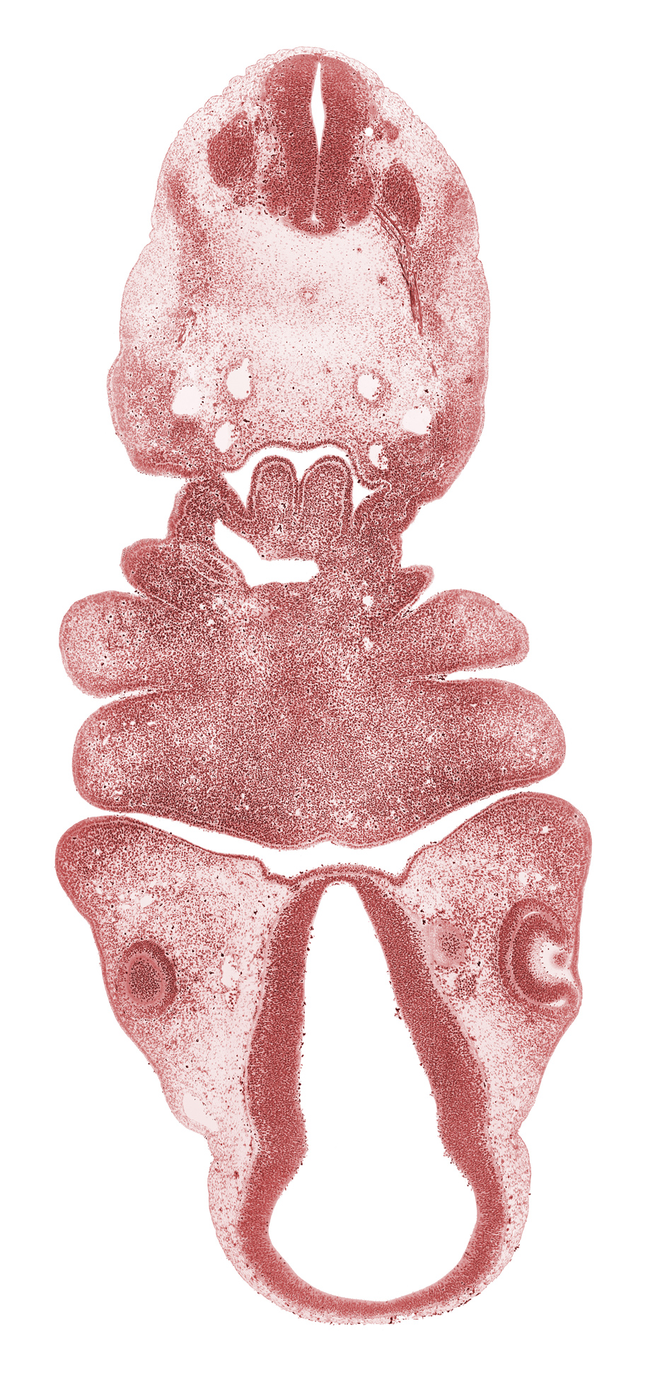 C-2 spinal nerve, aortic arch 4, aortic sac, caudal edge of C-2 spinal ganglion, cervical sinus, dorsal aorta, dorsal thalamus, edge of lens vesicle, edge of optic cup, edge of optic stalk (CN II), hypothalamus, inferior ganglion of vagus nerve (CN X), mandibular prominence of pharyngeal arch 1, maxillary prominence of pharyngeal arch 1, maxillary venous plexus, median mandibular groove, neural arch primordium, notochord, oral fissure, pharyngeal arch 2, pharyngeal arch 3, pharyngeal arch 4, pharyngeal groove 1, pharyngeal pouch 4, precardinal vein, pretectum, sulcus limitans, sulcus medius, synencephalon, ultimopharyngeal pouch, ventral thalamus