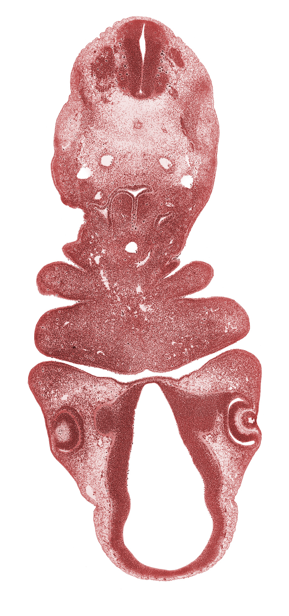 aortic sac, caudal edge of pharyngeal arch 3, cephalic edge of C-3 spinal ganglion, cephalic edge of pericardial cavity, diencephalon, diencoel (third ventricle), dorsal aorta, dorsal thalamus, edge of optic stalk (CN II), external layer of optic cup, internal layer of optic cup, laryngeal condensation, lens vesicle, mandibular prominence of pharyngeal arch 1, notochord, optic cup, optic stalk (CN II), oral fissure, pharyngeal arch 2, pharyngeal groove 1, pharyngeal pouch 4, precardinal vein, pretectum, spinal accessory nerve (CN XI), sulcus medius, synencephalon, ultimopharyngeal pouch, ventral thalamus