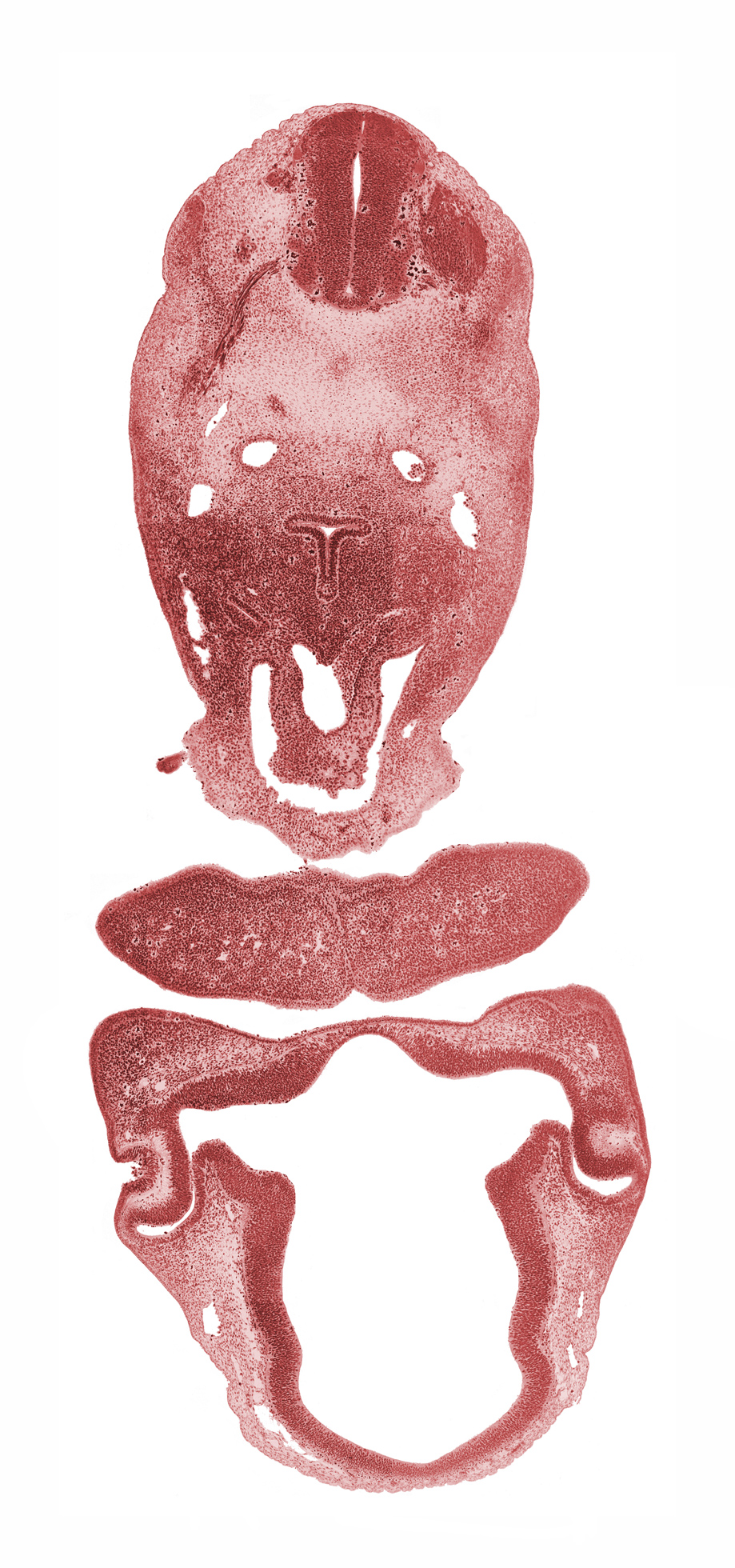 C-3 spinal ganglion, aortic sac, chiasmatic plate, diencoel (third ventricle), dorsal aorta, dorsal thalamus, epithelium of larynx, intraretinal space (optic vesicle cavity), junction of aortic sac and pulmonary arch, laryngeal condensation, lens pit, mandibular prominence of pharyngeal arch 1, maxillary prominence of pharyngeal arch 1, median mandibular groove, neural arch primordium, neural canal, notochord, optic stalk lumen (CN II), pericardial cavity, precardinal vein, sclerotome, sulcus medius, synencephalon, ventral thalamus