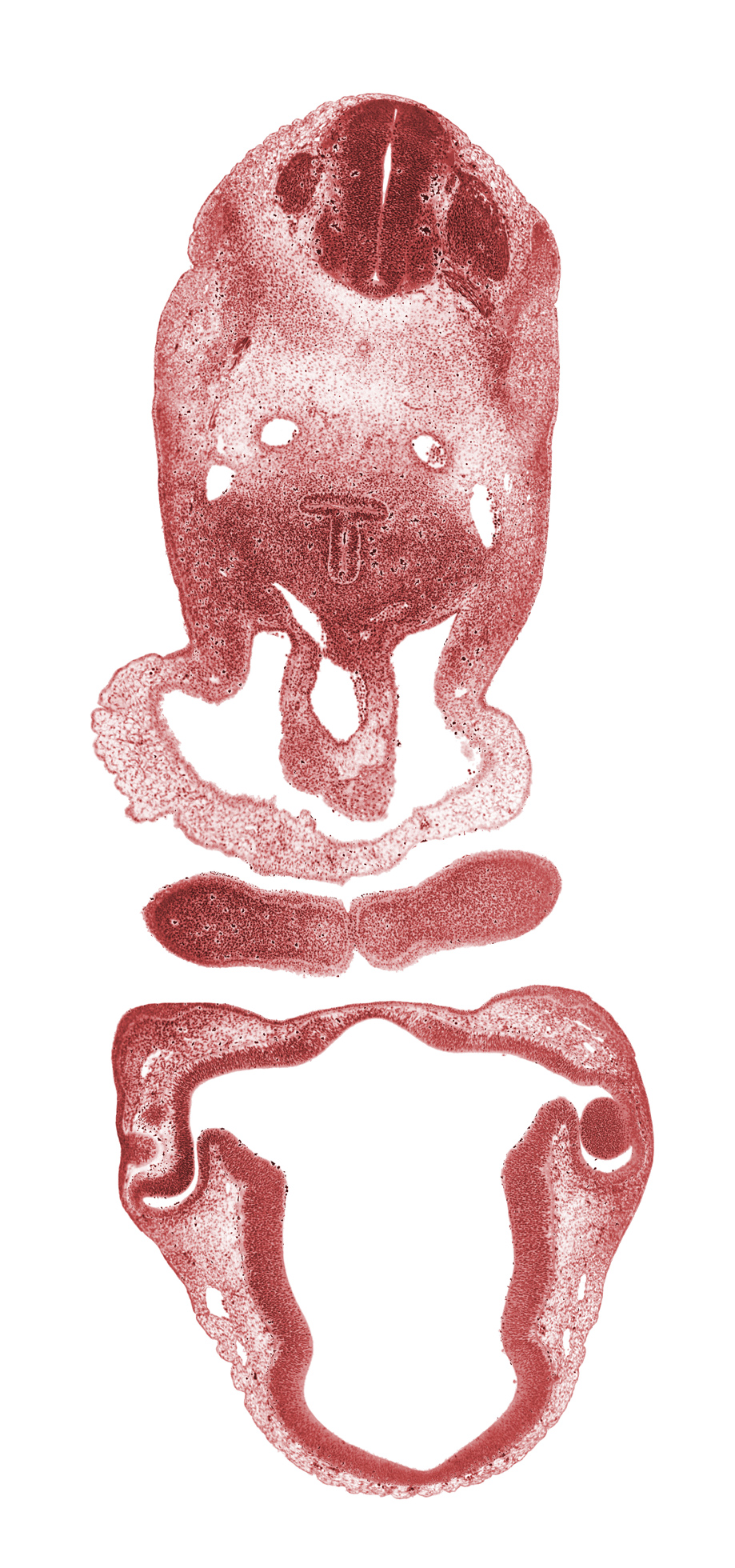 C-3 dorsal root, C-3 spinal ganglion, C-3 ventral root, alar plate(s), anterior dural venous plexus, aortic sac, basal plate, chiasmatic plate, diencoel (third ventricle), dorsal aorta, dorsal thalamus, edge of lens vesicle, external layer of optic cup, floor plate, internal layer of optic cup, intraretinal space (optic vesicle cavity), junction of maxillary and medial nasal prominences, laryngeal condensation, mandibular prominence of pharyngeal arch 1, median mandibular groove, optic stalk lumen (CN II), pericardial cavity, precardinal vein, pulmonary arch, roof plate, sulcus limitans, sulcus medius, ventral thalamus