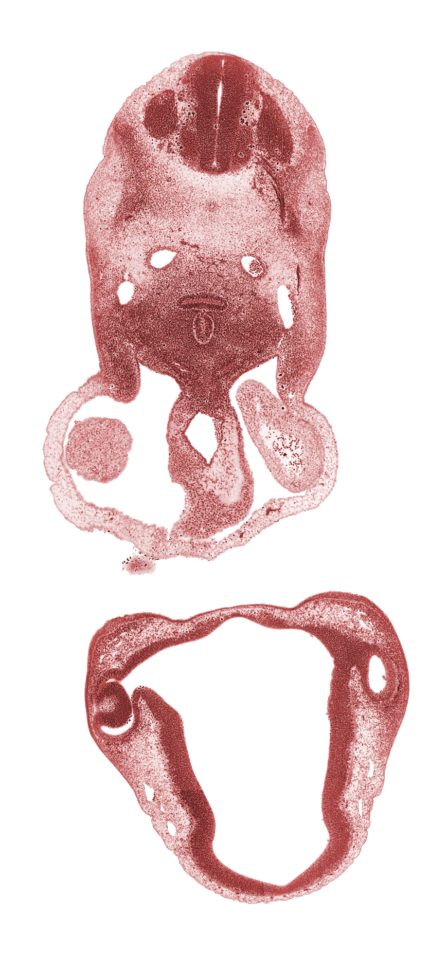 C-3 dorsal root, C-3 spinal ganglion, C-3 spinal nerve, C-3 ventral root, anterior dural venous plexus, chiasmatic plate, diencoel (third ventricle), dorsal aorta, dorsal thalamus, edge of left atrium, edge of mandibular prominence of pharyngeal arch 1, edge of right atrium, epithalamus, esophagus primordium, external layer of optic cup, internal layer of optic cup, intraretinal space (optic vesicle cavity), laryngeal condensation, maxillary venous plexus, mesocardium, notochord, optic stalk (CN II), optic stalk lumen (CN II), pericardial cavity, precardinal vein, spinal accessory nerve (CN XI), trachea, truncus arteriosus (outflow tract), ventral thalamus