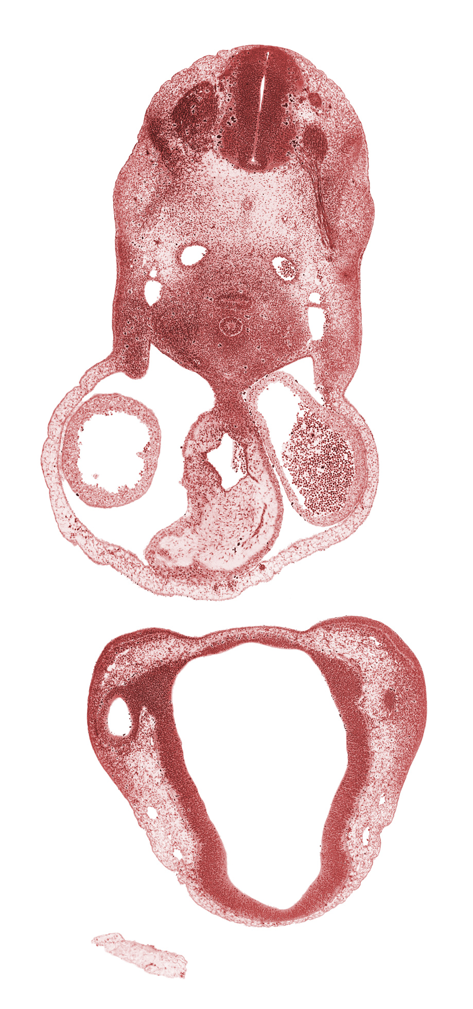 C-3 spinal nerve, anterior dural venous plexus, caudal part of C-3 spinal ganglion, cephalic edge of C-4 spinal ganglion, cervical plexus, chiasmatic plate, conotruncal ridge(s), conus cordis (outflow tract), dorsal aorta, dorsal thalamus, edge of cerebral primordium (vesicle), epithalamus, esophagus primordium, intraretinal space (optic vesicle cavity), left precardinal vein, medial nasal prominence(s), mesocardium, notochord, optic groove, pericardial cavity, right atrium, trachea, truncus arteriosus (outflow tract)