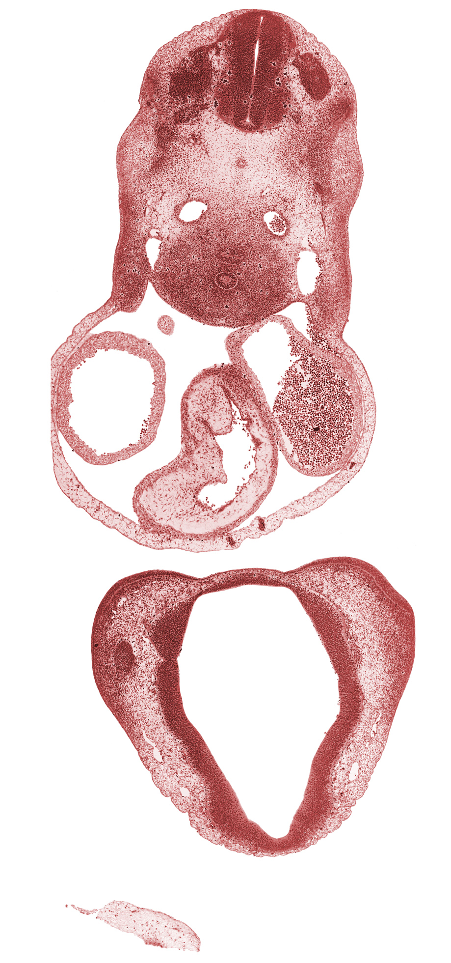 C-4 spinal ganglion, alar plate(s), basal plate, cephalic edge of sinus venosus, cerebral primordium (vesicle), cervical plexus, chiasmatic plate, conotruncal ridge(s), conus cordis (outflow tract), corpus striatum, dorsal aorta, edge of optic cup, epithalamus, esophagus primordium, floor plate, left atrium, left precardinal vein, medial nasal prominence(s), notochord, optic groove, pericardial cavity, right atrium, right precardinal vein, roof plate, sulcus limitans, trachea, truncus arteriosus (outflow tract)