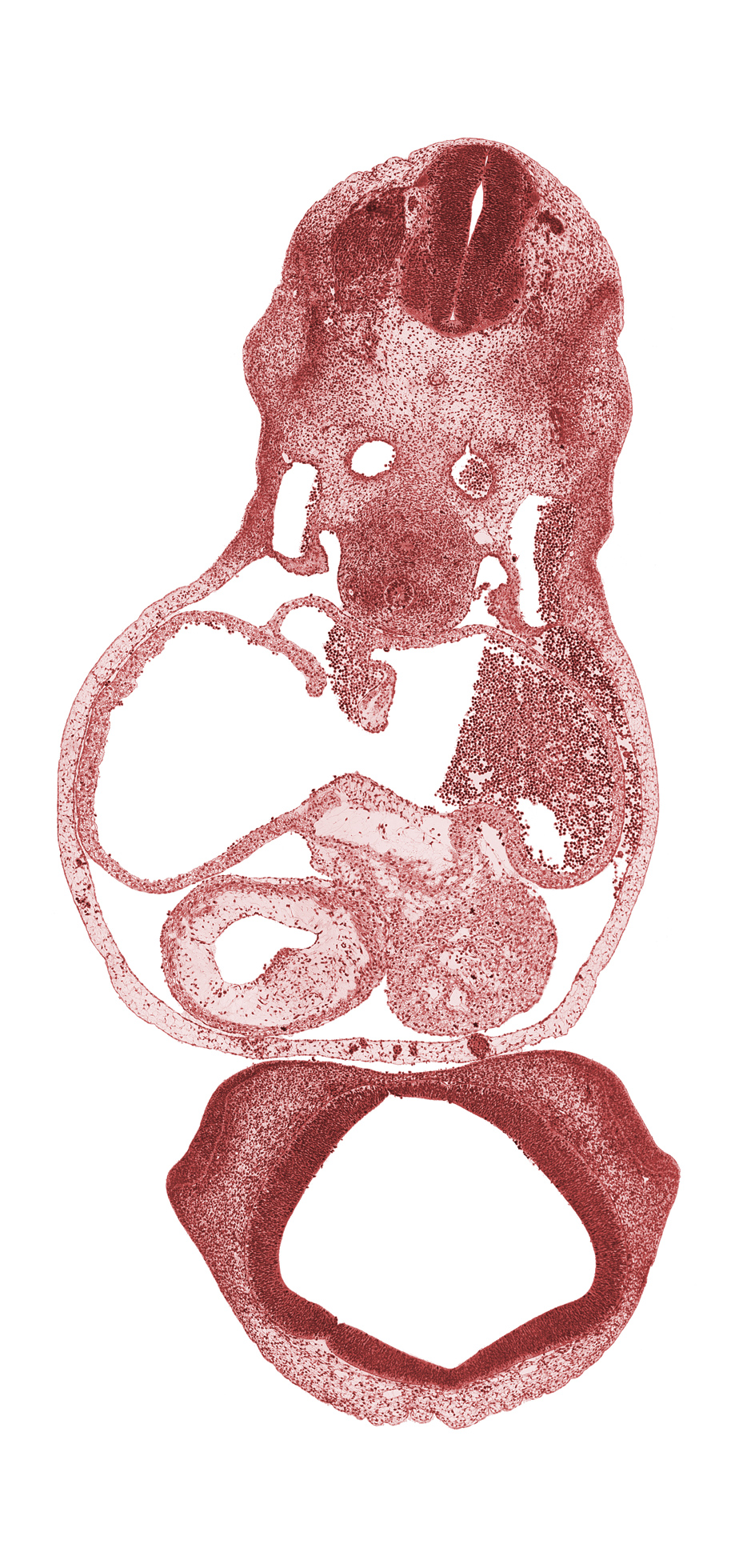 anterior dural venous plexus, caudal edge of C-4 spinal ganglion, cerebral primordium (vesicle), conus cordis (outflow tract), diencoel (third ventricle), esophagus primordium, lateral nasal prominence, lateral ventricle, left atrium, left venous valve, left ventricle, medial nasal prominence(s), nasal disc (olfactory placode), notochord, origin of dorsal intersegmental artery, origin of left common cardinal vein, origin of right common cardinal vein, primary interatrial foramen (foramen primum), primary interatrial septum (septum primum), right atrium, right venous valve, sinus venosus, trachea