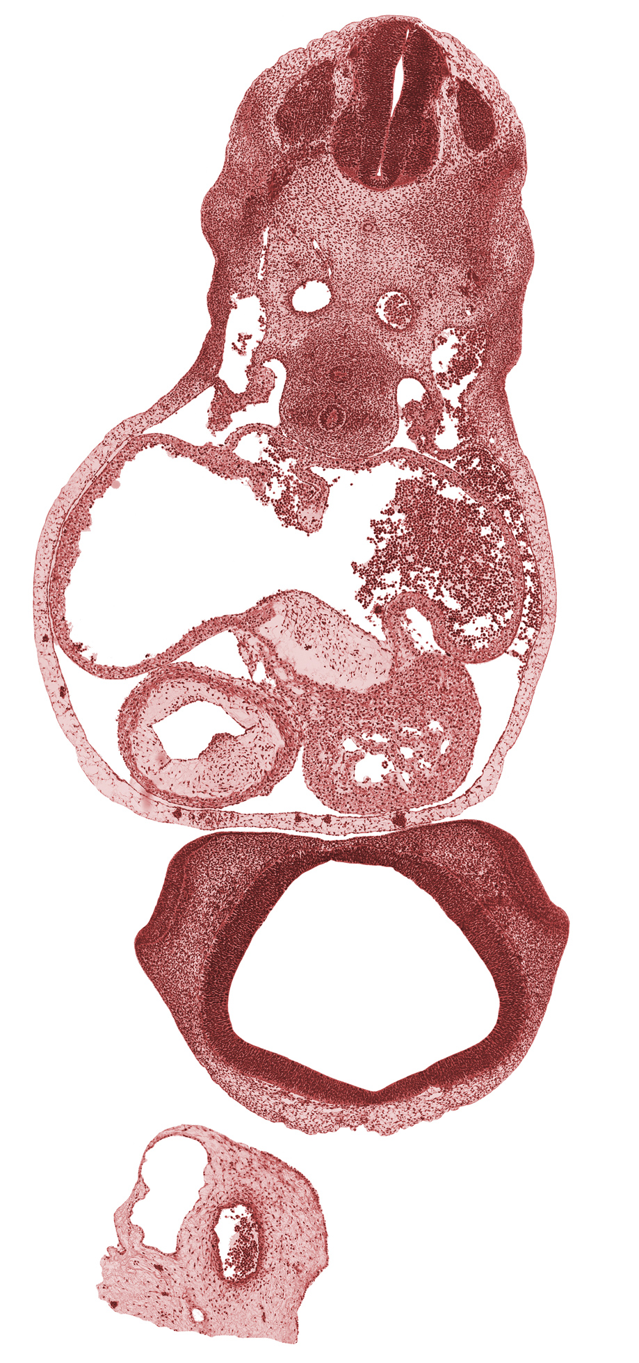 C-5 spinal ganglion, conus cordis (outflow tract), diencoel (third ventricle), esophagus primordium, lateral nasal prominence, left atrium, left common cardinal vein, left venous valve, left ventricle, medial nasal prominence(s), nasal pit, notochord, olfactory area, pericardial cavity, postcardinal vein, primary interatrial foramen (foramen primum), primary interatrial septum (septum primum), right atrium, right common cardinal vein, right venous valve, sclerotome, shoulder region, sinus venosus, trachea, ventral atrioventricular endocardial cushion