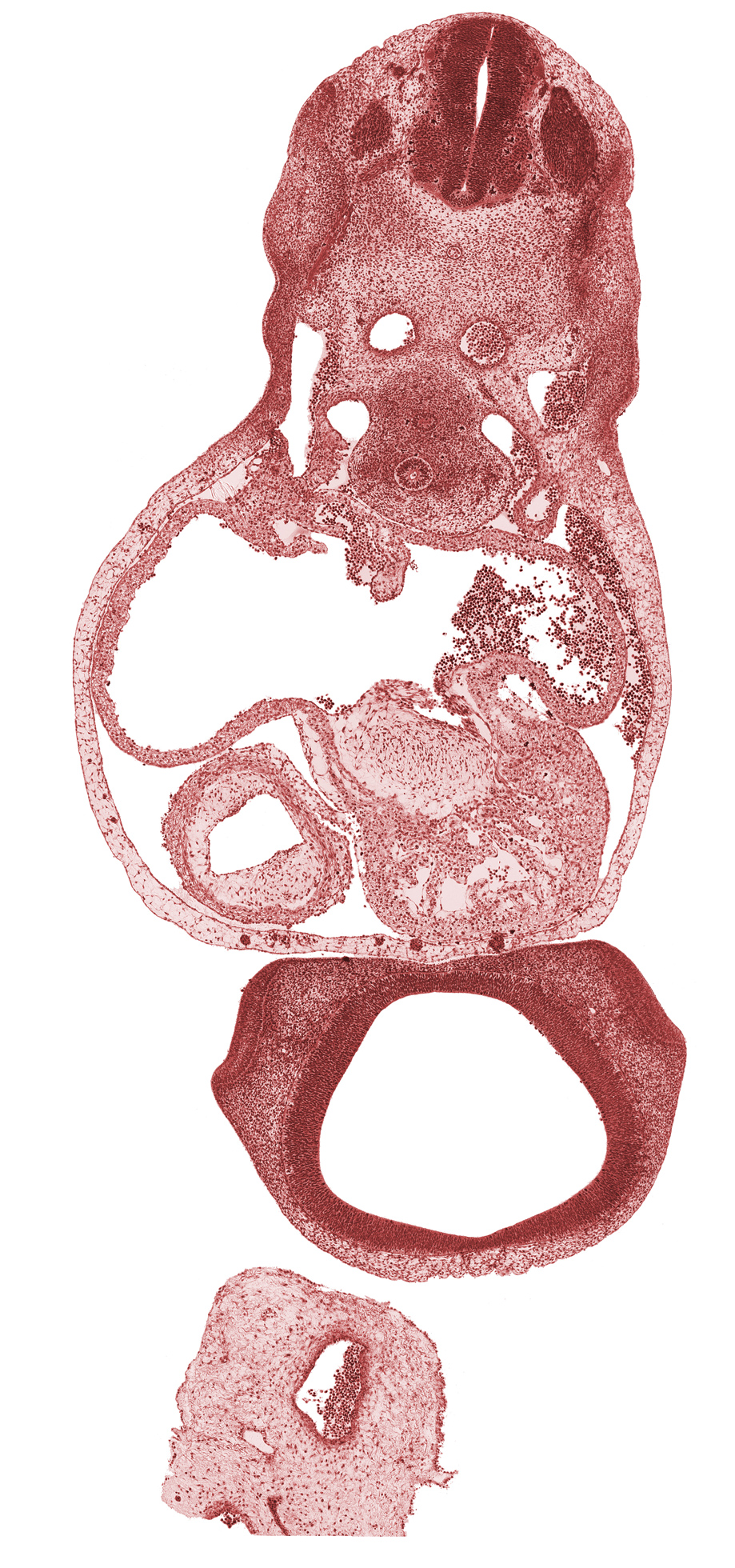 C-5 spinal ganglion, cerebral primordium (vesicle), commissural plate, common pulmonary vein, diencoel (third ventricle), esophagus primordium, left atrium, left common cardinal vein, left venous valve, left ventricle, notochord, olfactory area, pericardial cavity, pericardioperitoneal canal (pleural cavity), postcardinal vein, primary interatrial foramen (foramen primum), primary interatrial septum (septum primum), pulmonary pit, right atrium, right common cardinal vein, right venous valve, sclerotome, sinus venosus, trabecular part of right ventricle, trachea