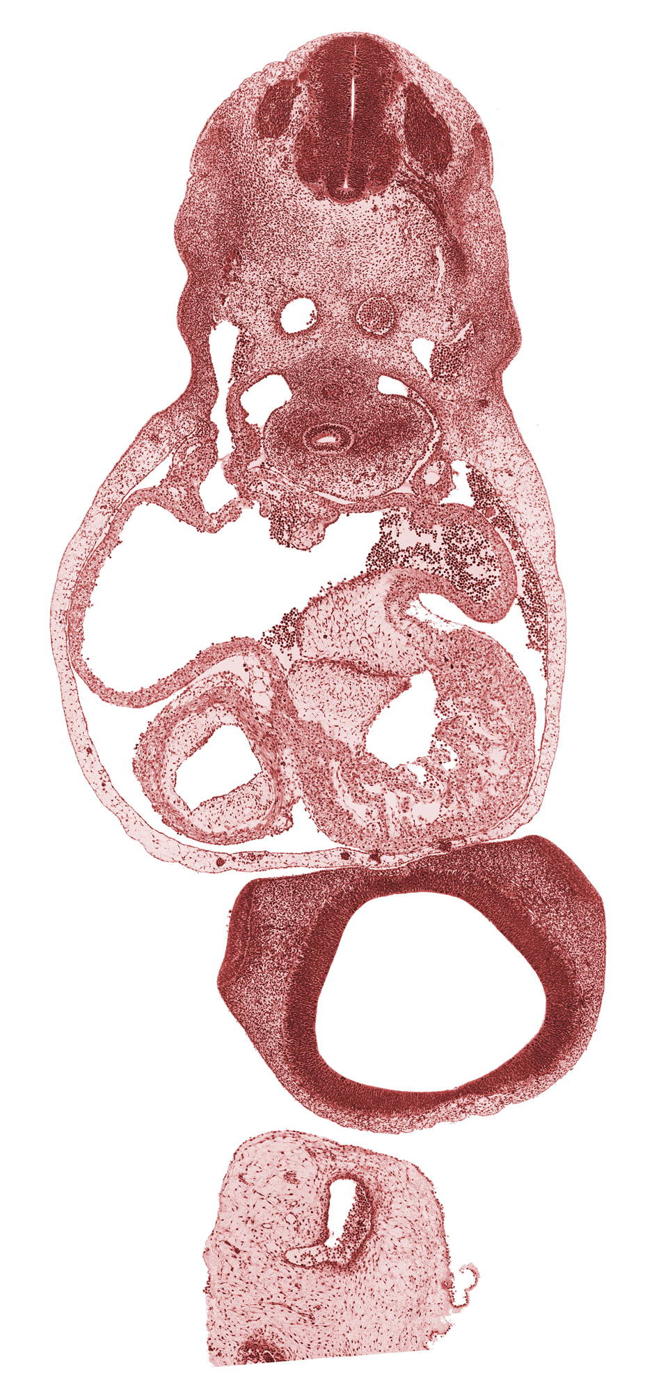 C-5 spinal ganglion, atrioventricular groove, common atrioventricular canal, dorsal aorta, dorsal atrioventricular endocardial cushion, junction of lateral and medial nasal prominences, lateral ventricle, left atrium, left common cardinal vein, left ventricle, pericardial cavity, primary interatrial foramen (foramen primum), right atrium, right common cardinal vein, right postcardinal vein, shoulder region, trabecular part of right ventricle, tracheal bifurcation, ventral atrioventricular endocardial cushion