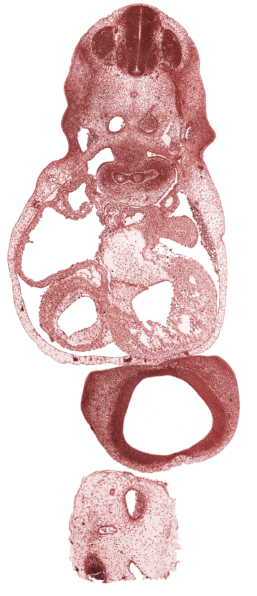 C-5 spinal ganglion, C-5 spinal nerve, atrioventricular groove, caudal edge of left atrium, cerebral primordium (vesicle), common atrioventricular canal, dorsal aorta, dorsal atrioventricular endocardial cushion, junction of lateral and medial nasal prominences, left common cardinal vein, left postcardinal vein, left ventricle, notochord, pericardioperitoneal canal (pleural cavity), pleuropericardial membrane, right atrium, right common cardinal vein, right lung sac, right postcardinal vein, telencephalon, trabecular part of right ventricle, tracheal bifurcation, ventral atrioventricular endocardial cushion