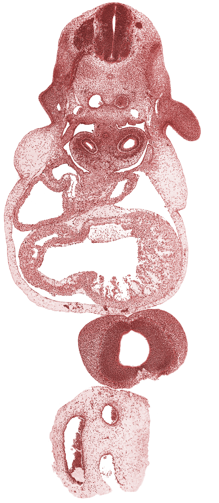 anterior interventricular groove, caudal edge of C-5 spinal ganglion, dorsal aorta, edge of diencoel (third ventricle), frontal prominence, interventricular foramen, junction of right common cardinal vein and sinus venosus, lamina terminalis, left common cardinal vein, left ventricle, neural arch primordium, notochord, pericardioperitoneal canal (pleural cavity), pleuropericardial membrane, posterior interventricular groove, right atrium, right common cardinal vein, right ventricle, sclerotome, shoulder region, sinus venosus, telencephalon medium, upper limb