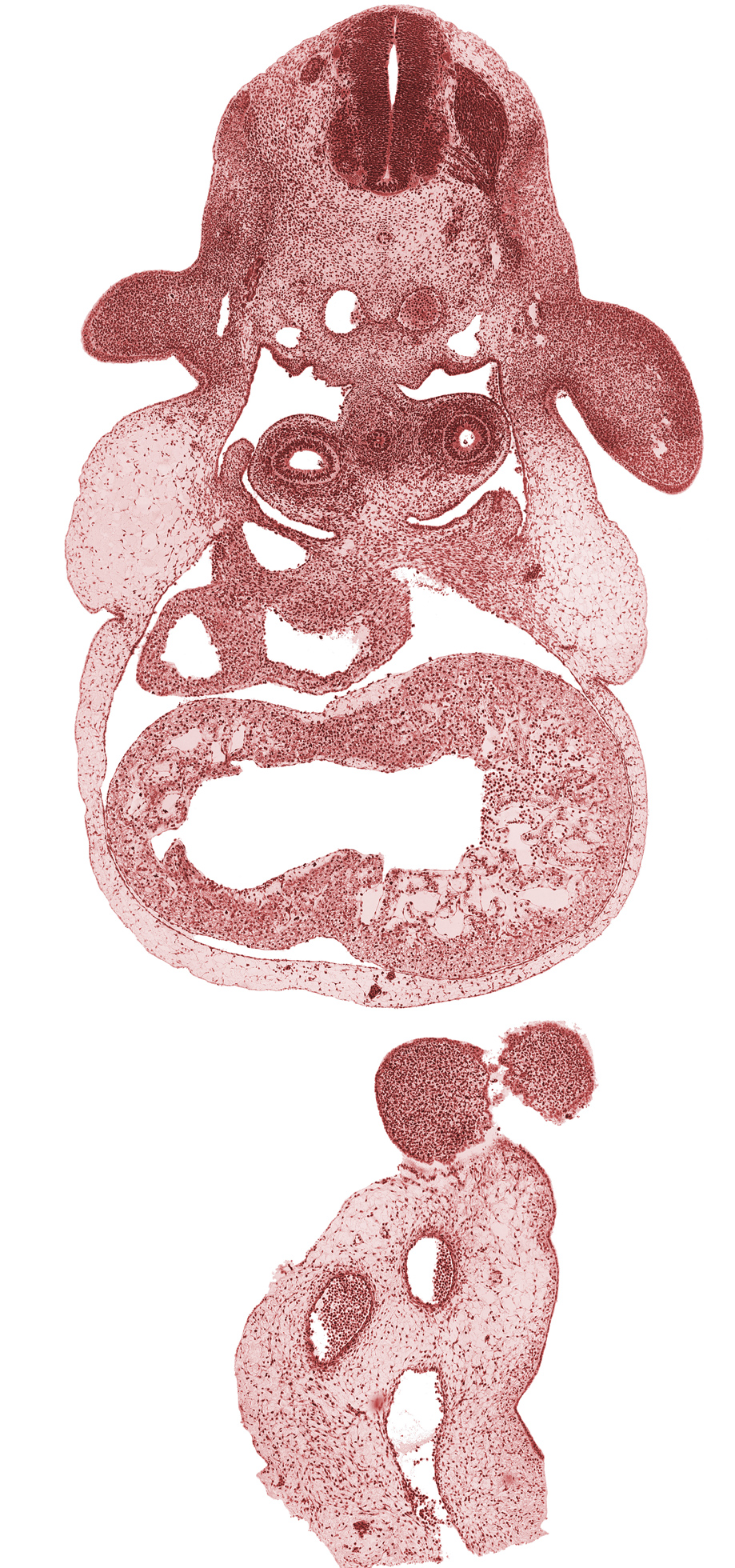 C-6 dorsal root, C-6 spinal ganglion, C-6 spinal nerve, C-6 ventral root, anterior interventricular groove, caudal part of right atrium, caudal part of sinus venosus, dorsal aorta, dorsal meso-esophagus, edge of frontal prominence, esophagus primordium, interventricular foramen, left primary bronchus, left ventricle, mesocardium, notochord, pericardial cavity, pericardioperitoneal canal (pleural cavity), right ventricle, upper limb