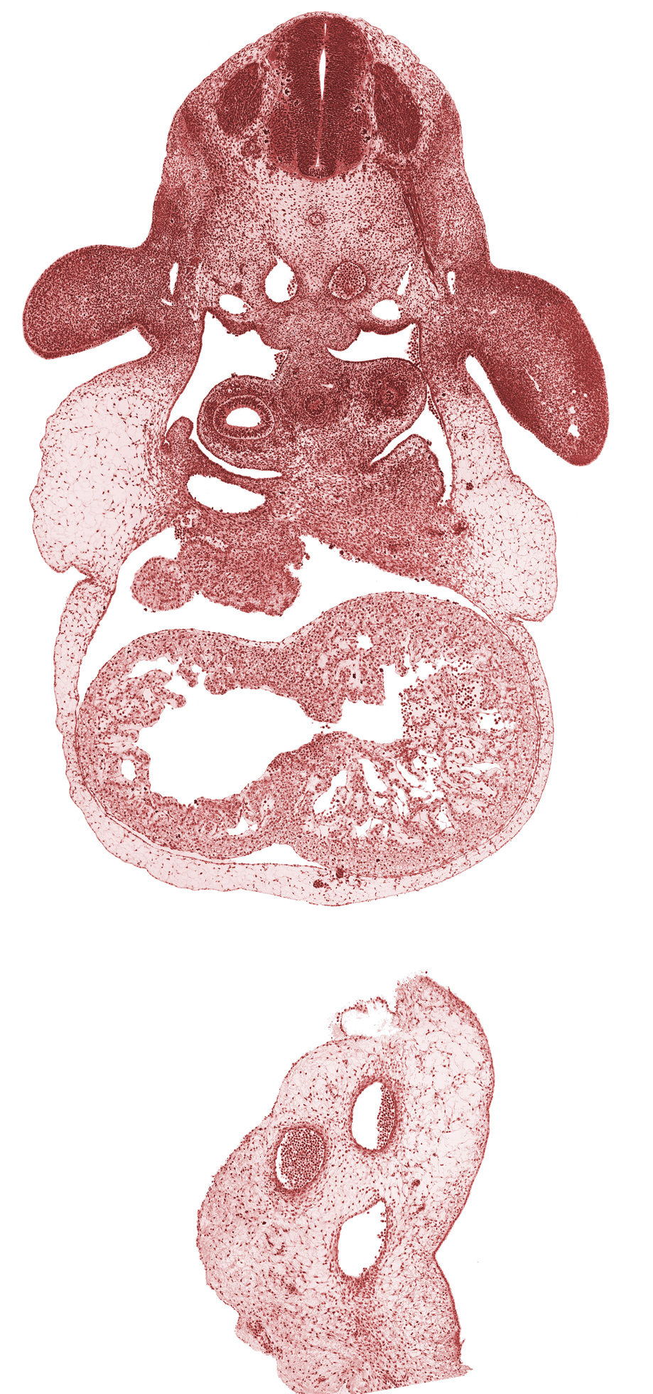 C-6 spinal ganglion, C-6 spinal nerve, caudal edge of interventricular foramen, caudal edge of left primary bronchus, caudal edge of right atrium, caudal edge of sinus venosus, dorsal aorta, gonadal ridge, inferior vena cava, junction of dorsal aorta and dorsal intersegmental artery, left ventricle, pericardial cavity, pericardial sac, pericardioperitoneal canal (pleural cavity), postcardinal vein, right primary bronchus, right ventricle, trabecular part of left ventricle, upper limb