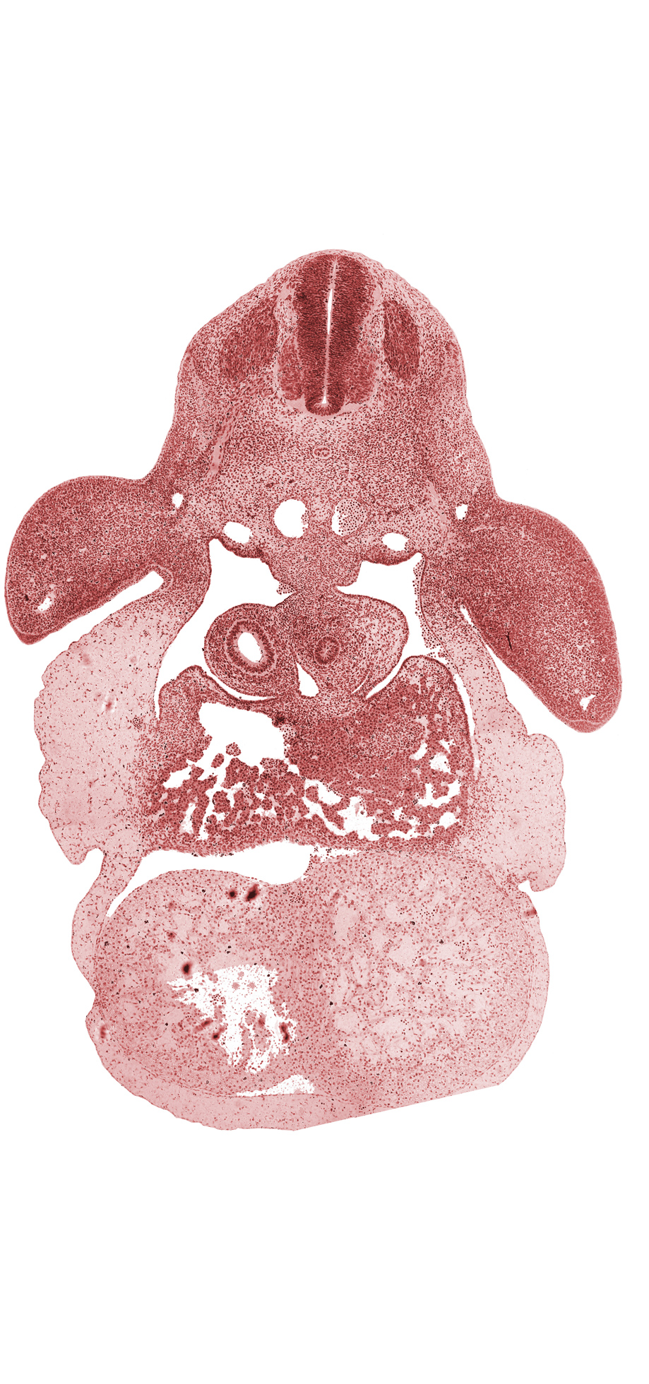 C-6 spinal ganglion, brachial plexus, cephalic recess of lesser sac (omental bursa), dorsal aorta, esophagus primordium, gonadal ridge, hepatic sinusoid, inferior vena cava, intermediate zone, interventricular septum, left hepatic vein, left ventricle, marginal zone, neural canal, pericardial sac, postcardinal vein, right hepatic vein, right primary bronchus, right ventricle, septum transversum, upper limb, ventricular zone