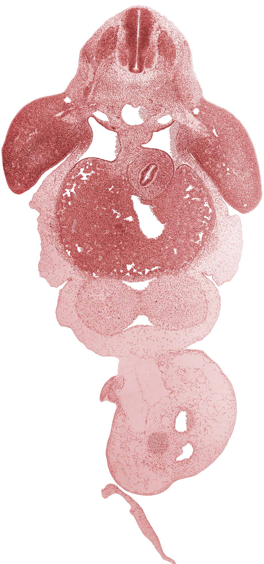 C-7 spinal ganglion, allantois, anterior interventricular groove, aorta, apical ectodermal ridge, brachial plexus, cephalic recess of lesser sac (omental bursa), common umbilical vein, ductus venosus, interventricular septum, left umbilical artery, liver, marginal vein, notochord, pericardial cavity, posterior interventricular groove, right umbilical artery, stomach, upper limb