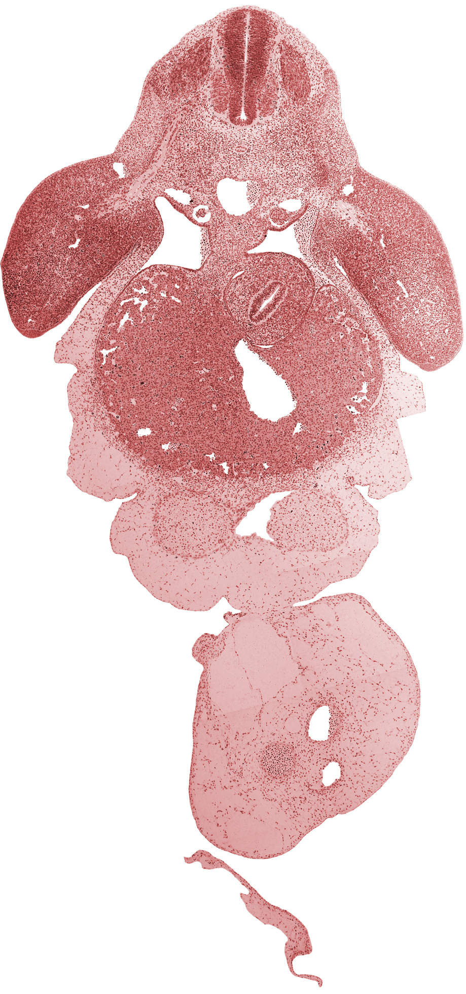 C-7 spinal ganglion, allantois, aorta, brachial plexus, caudal edge of left ventricle, caudal edge of pericardial cavity, caudal edge of right ventricle, cephalic recess of lesser sac (omental bursa), common umbilical vein, dorsal mesogastrium, ductus venosus, left umbilical artery, peritoneal cavity, postcardinal vein, right umbilical artery, septum transversum, stomach