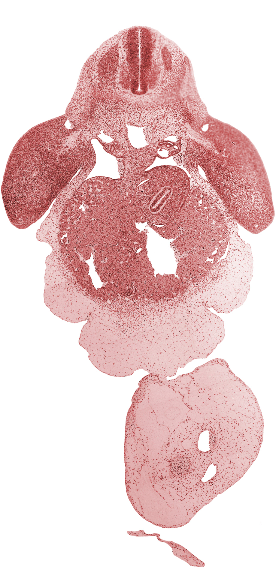 C-7 spinal ganglion, allantois, aorta, apical ectodermal ridge, cephalic recess of lesser sac (omental bursa), common umbilical vein, dermatome, dorsal mesogastrium, ductus venosus, left lobe of liver, left umbilical artery, myotome, neural arch primordium, origin of dorsal intersegmental artery, peritoneal cavity, postcardinal vein, right umbilical artery, sclerotome, septum transversum, stomach, umbilical coelom, umbilical cord