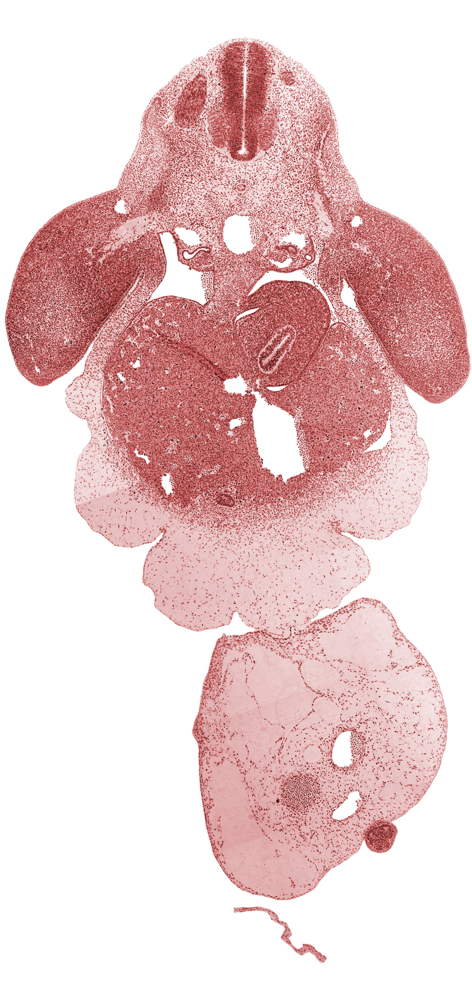 aorta, brachial plexus, caudal part of pericardial sac, cephalic edge of C-8 spinal ganglion, common umbilical vein, dermatome, dorsal mesogastrium, ductus venosus, gall bladder primordium, junction of mesonephric duct and tubule, left lobe of liver, left umbilical artery, lesser sac, myotome, neural tube, post anal gut, postcardinal vein, right lobe of liver, right umbilical artery, septum transversum, stomach, tip of caudal eminence, umbilical coelom, umbilical cord, upper limb