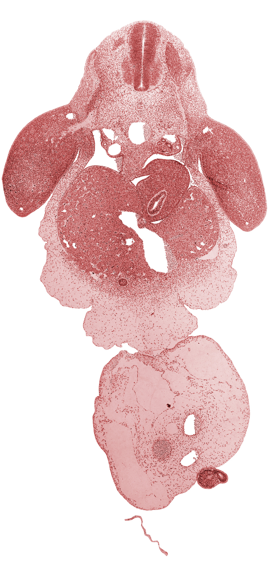 C-8 spinal ganglion, C-8 spinal nerve, C-8 ventral root, amnion on surface of umbilical cord, aorta, brachial plexus, caudal eminence, common umbilical vein, ductus venosus, gall bladder primordium, left lobe of liver, left umbilical artery, lesser  sac, marginal vein, mesonephric duct, neural tube, notochord, peritoneal cavity, post anal gut, postcardinal vein, right lobe of liver, right umbilical artery, septum transversum, spleen primordium, stomach, umbilical coelom