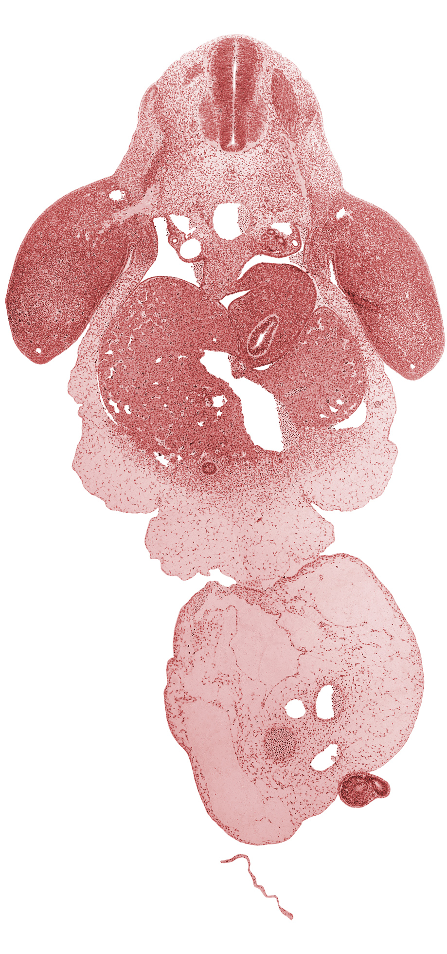 C-8 spinal ganglion, C-8 spinal nerve, C-8 ventral ramus, C-8 ventral root, allantois, amnion on surface of umbilical cord, caudal eminence, common umbilical vein, dorsal mesogastrium, ductus venosus, gall bladder primordium, intermediate zone, left umbilical artery, lesser sac, marginal vein, marginal zone, mesonephric duct, neural tube, notochord, peritoneal cavity, post anal gut, right umbilical artery, septum transversum, spleen primordium, surface epithelium, upper limb, ventricular zone