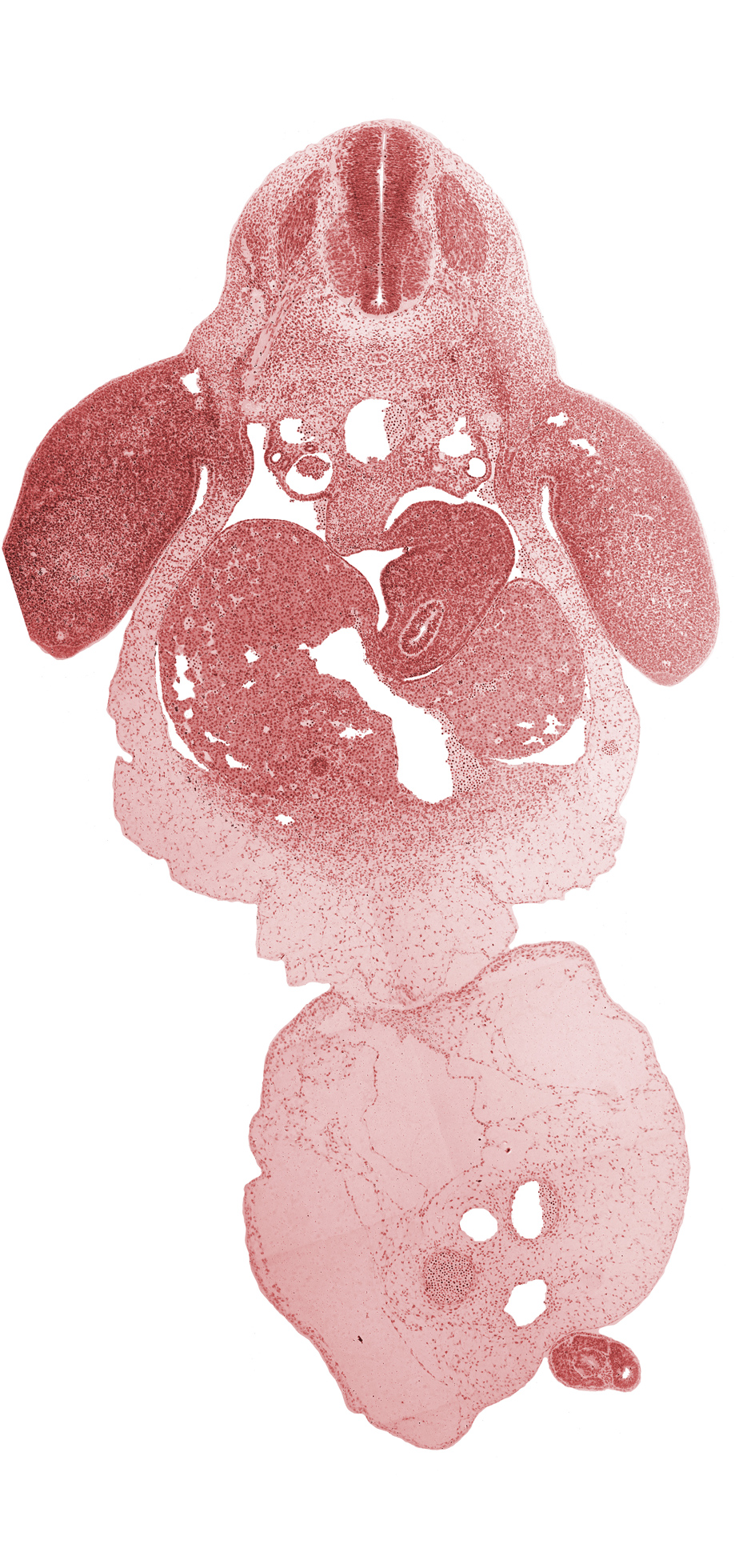 C-8 spinal ganglion, aorta, bile duct, common umbilical vein, dorsal mesentery, dorsal mesogastrium, ductus venosus, left lobe of liver, left umbilical artery, lesser  sac, marginal vein, mesonephric duct, neural canal, neural tube, notochord, post anal gut, postcardinal vein, right lobe of liver, right umbilical artery, sclerotome, septum transversum, spleen primordium, stomach, umbilical coelom, umbilical cord, ventral mesogastrium