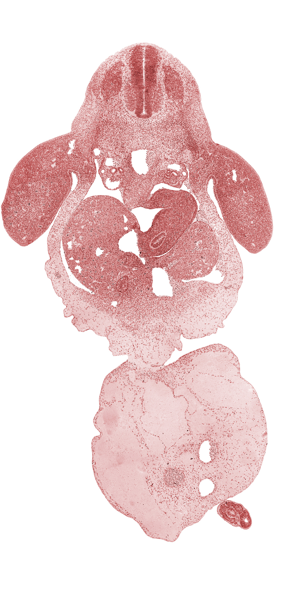 C-8 spinal ganglion, alar plate(s), allantois, amnion on surface of umbilical cord, basal plate, bile duct, caudal eminence, coccygeal somites, common umbilical vein, distal part of stomach, ductus venosus, floor plate, glomerular capsule, hepatic sinusoid, involuting right umbilical vein, left lobe of liver, left umbilical artery, lesser  sac, mesonephric duct, neural tube, notochord, post anal gut, postcardinal vein, right umbilical artery, roof plate, sclerotome, septum transversum, umbilical coelom, upper limb, ventral pancreas