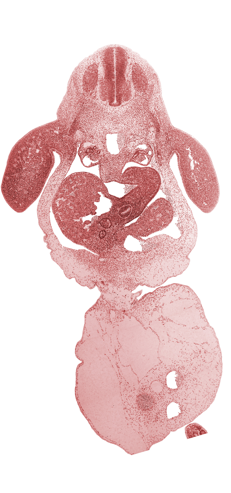 C-8 spinal ganglion, amnion on surface of umbilical cord, bile duct, caudal eminence, coccygeal somites, common umbilical vein, dorsal mesentery, hepatic duct(s), hepatic sinusoid, intermediate zone, junction of ductus venosus and left umbilical vein, junction of duodenum and stomach, junction of umbilical cord and ventral body wall, left lobe of liver, left umbilical artery, lesser  sac, marginal zone, mesonephric duct, mesonephric tubule(s), neural canal, neural tube, peritoneal cavity, post anal gut, right umbilical artery, septum transversum, umbilical coelom, umbilical cord, upper limb, ventricular zone